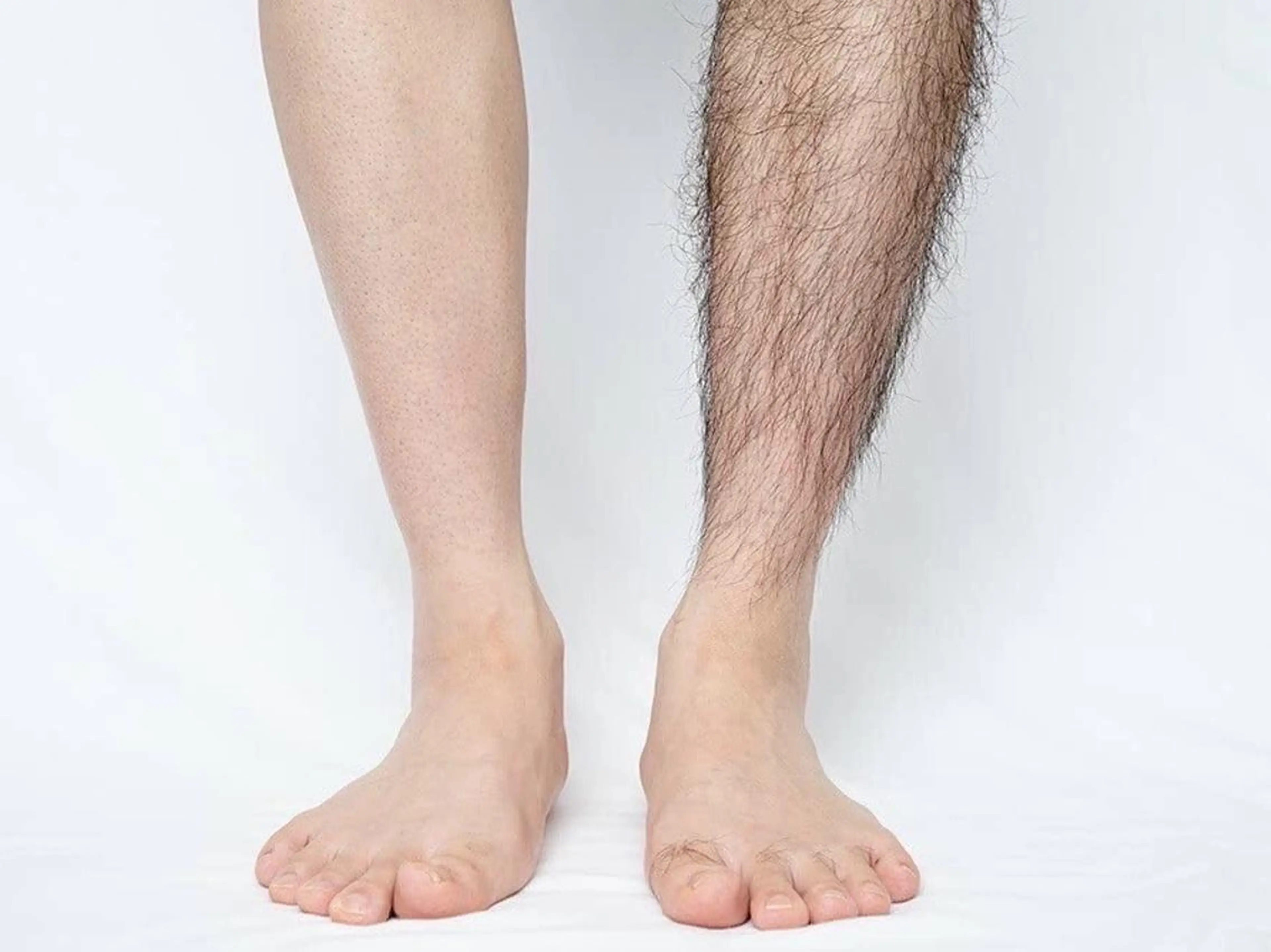 脱毛 米山 美紀子のエステ・リラクイメージ