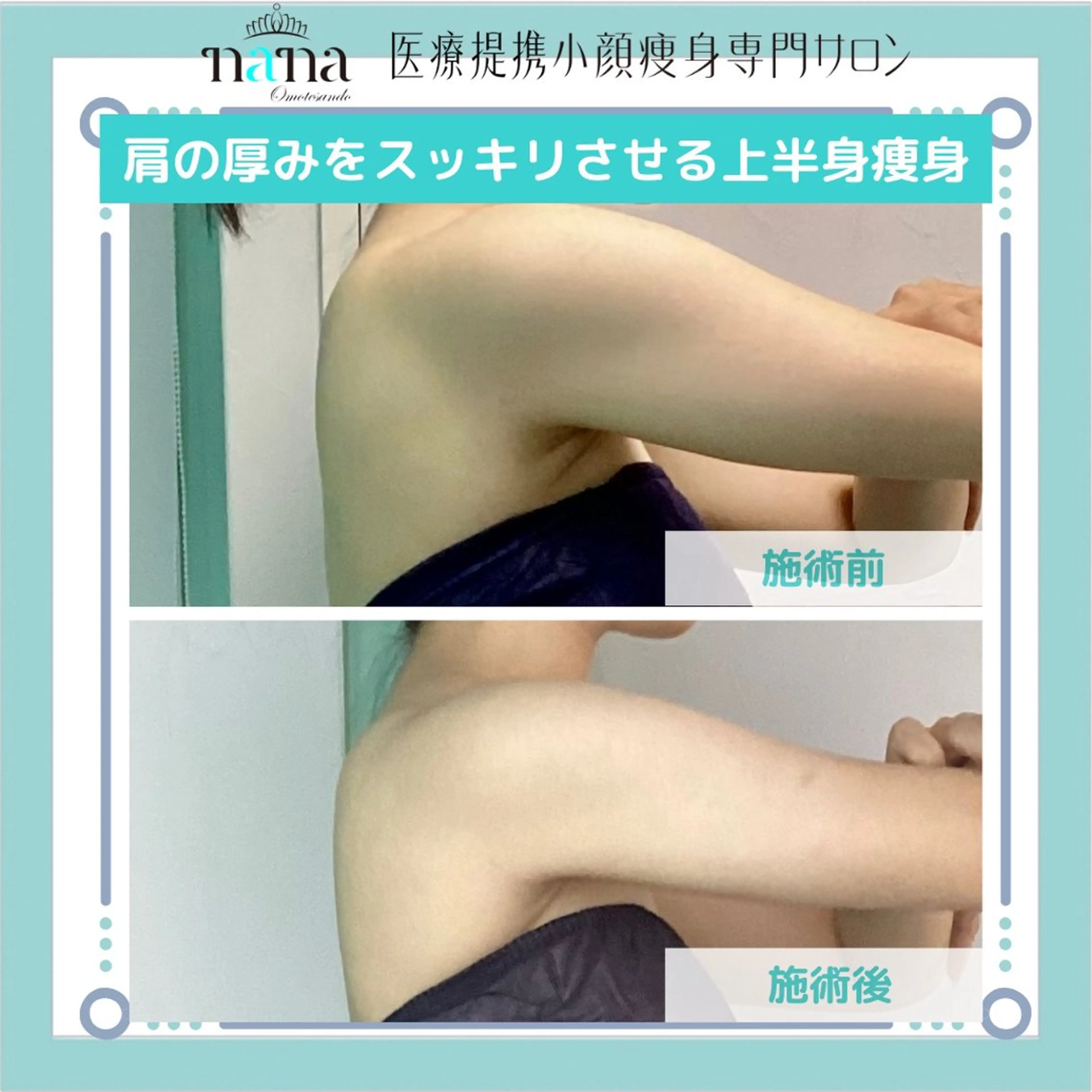 エステ リラク 小顔痩身インディバ Nana表参道のエステ・リラクイメージ