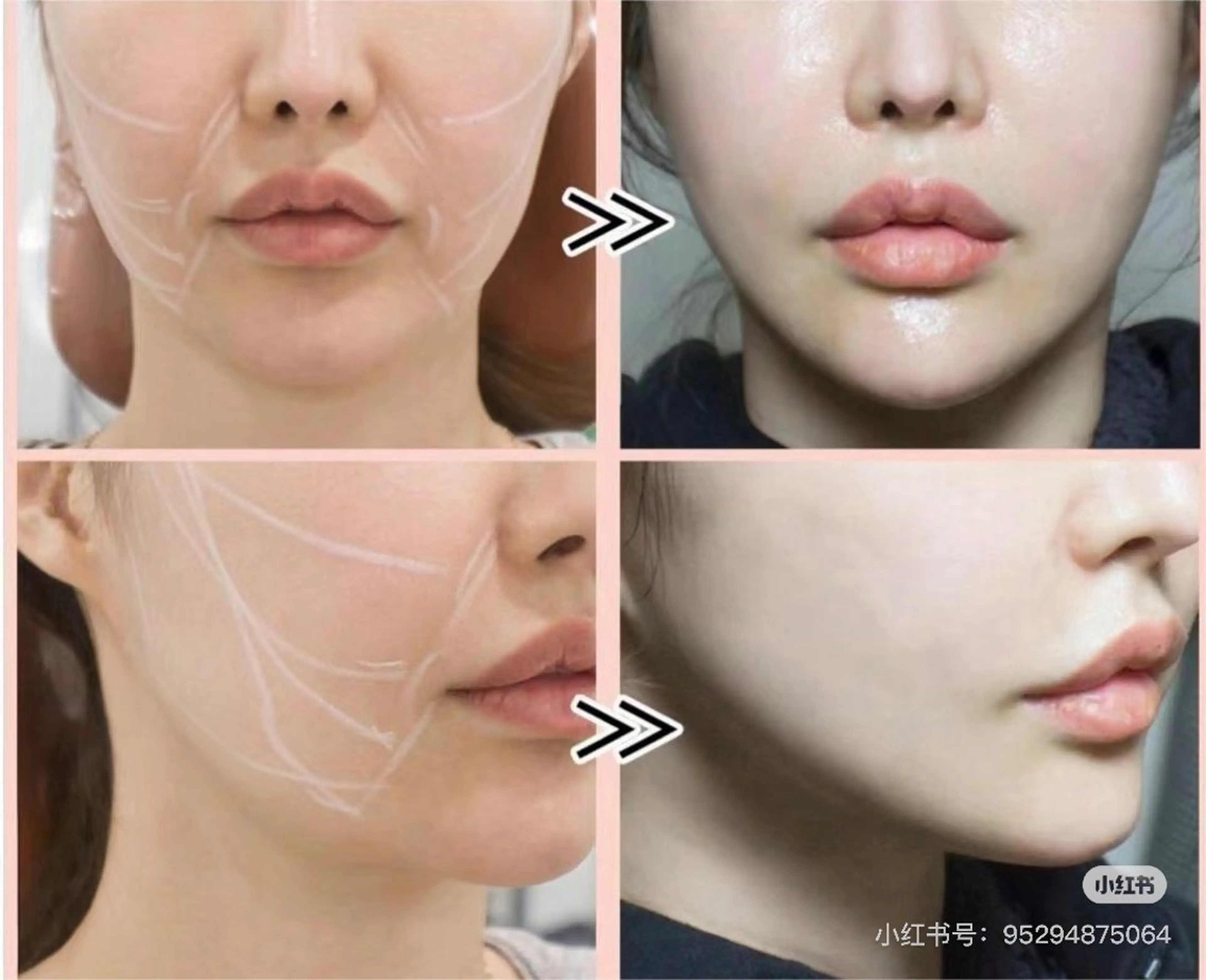 ネイル エステ aliaハイフ&水光ジェットサロン所属・aliaハーブ水光店 エステティシャン募集のエステ・リラクイメージ