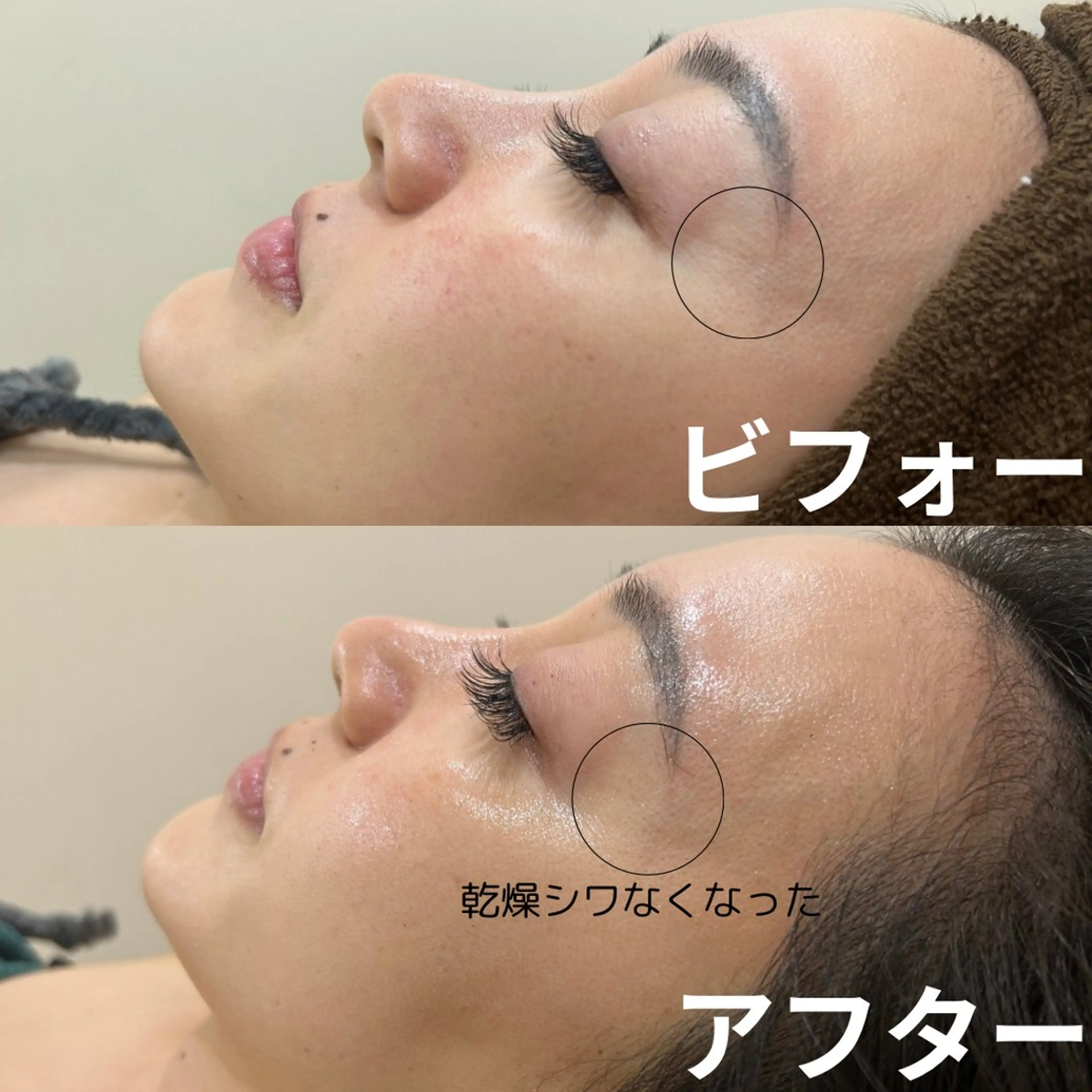 その他 NiU.BEAUTY🥥池袋店所属・ハーブピーリング専門 NiU.BEAUTYのエステ・リラクイメージ