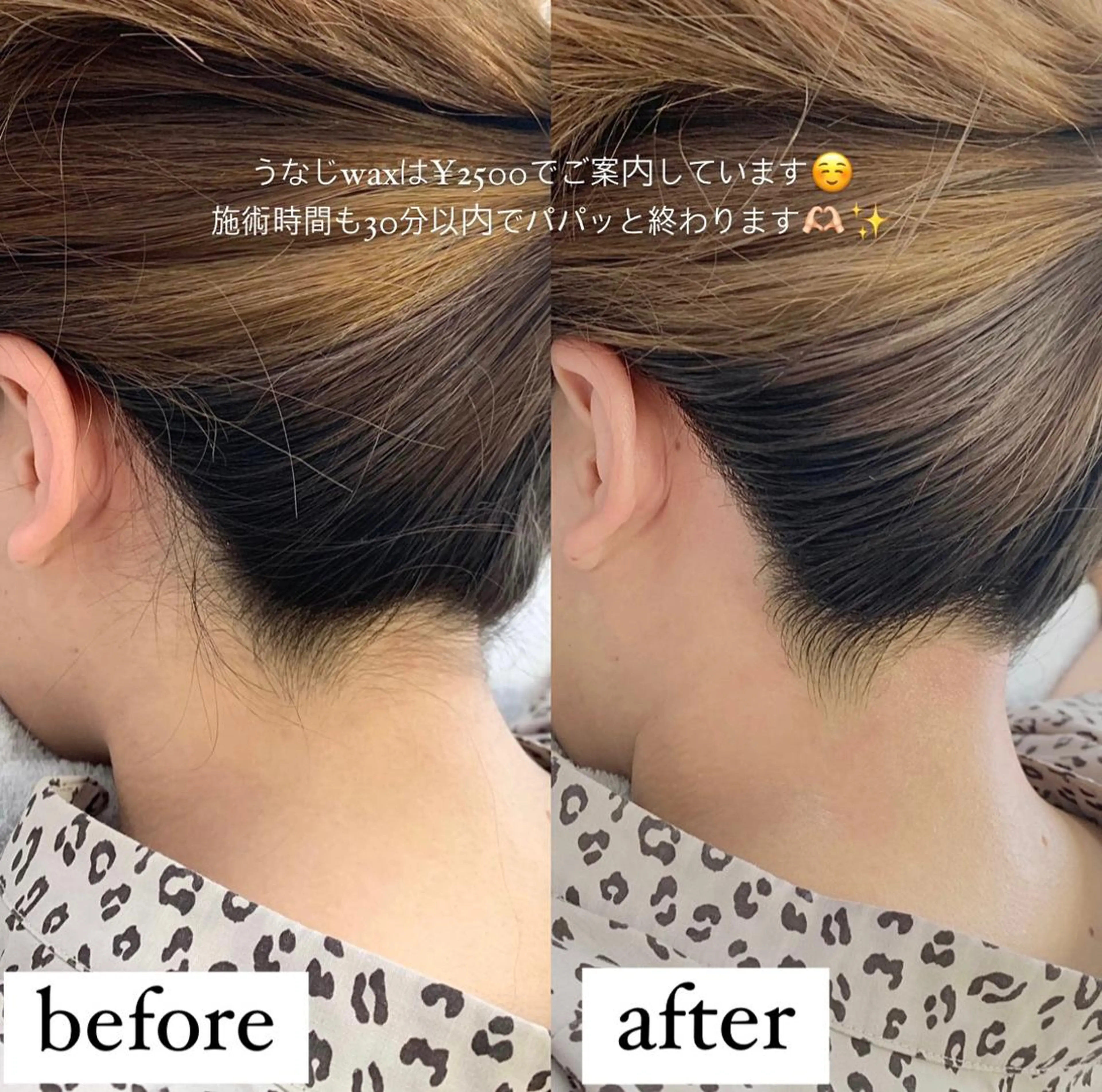 キッズ 脱毛 salonLADYSTYLE所属・稲嶺 美華のエステ・リラクイメージ