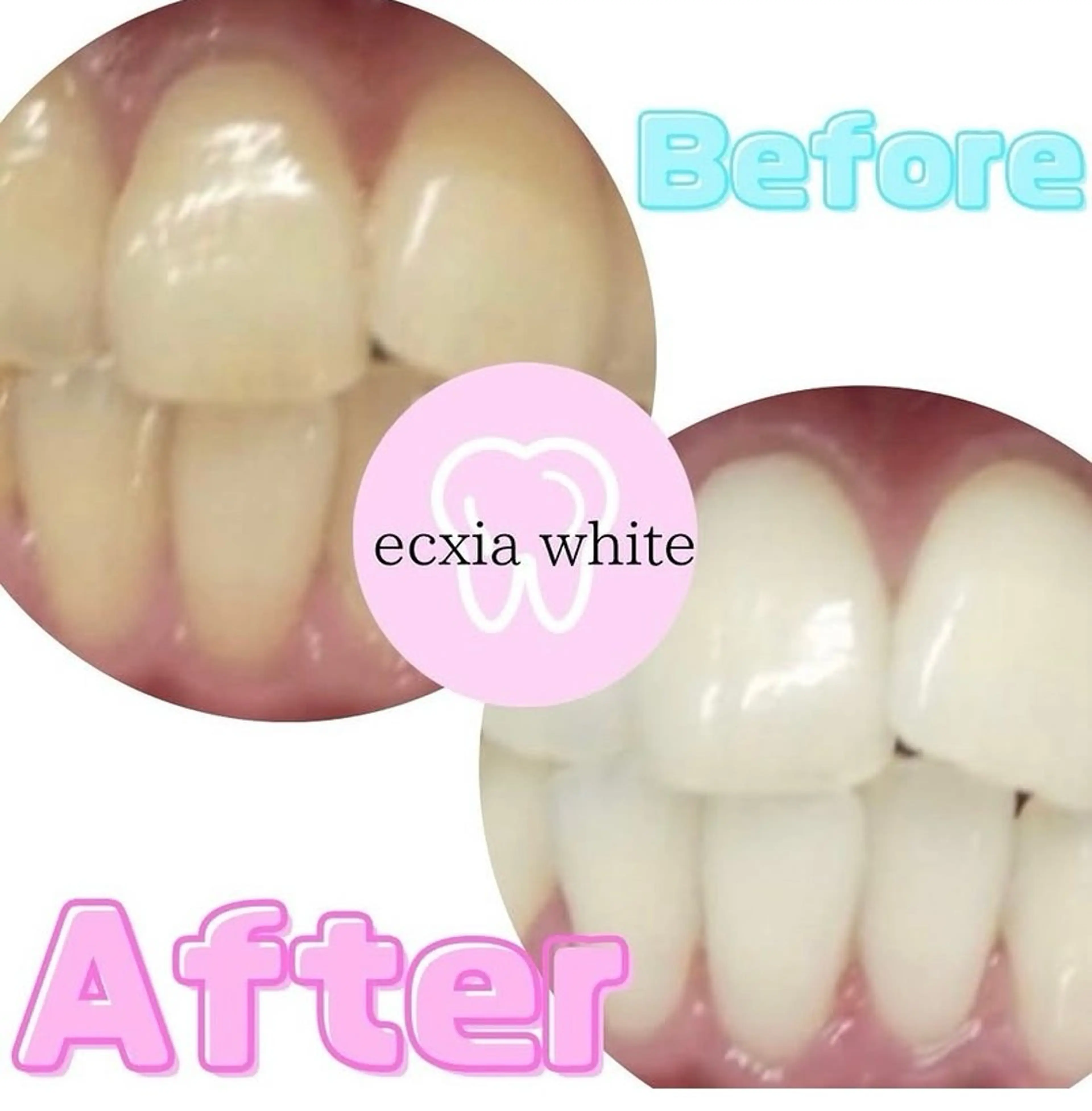 その他 エクシアホワイトニング草津店所属・エクシア ホワイトニング草津店のその他イメージ