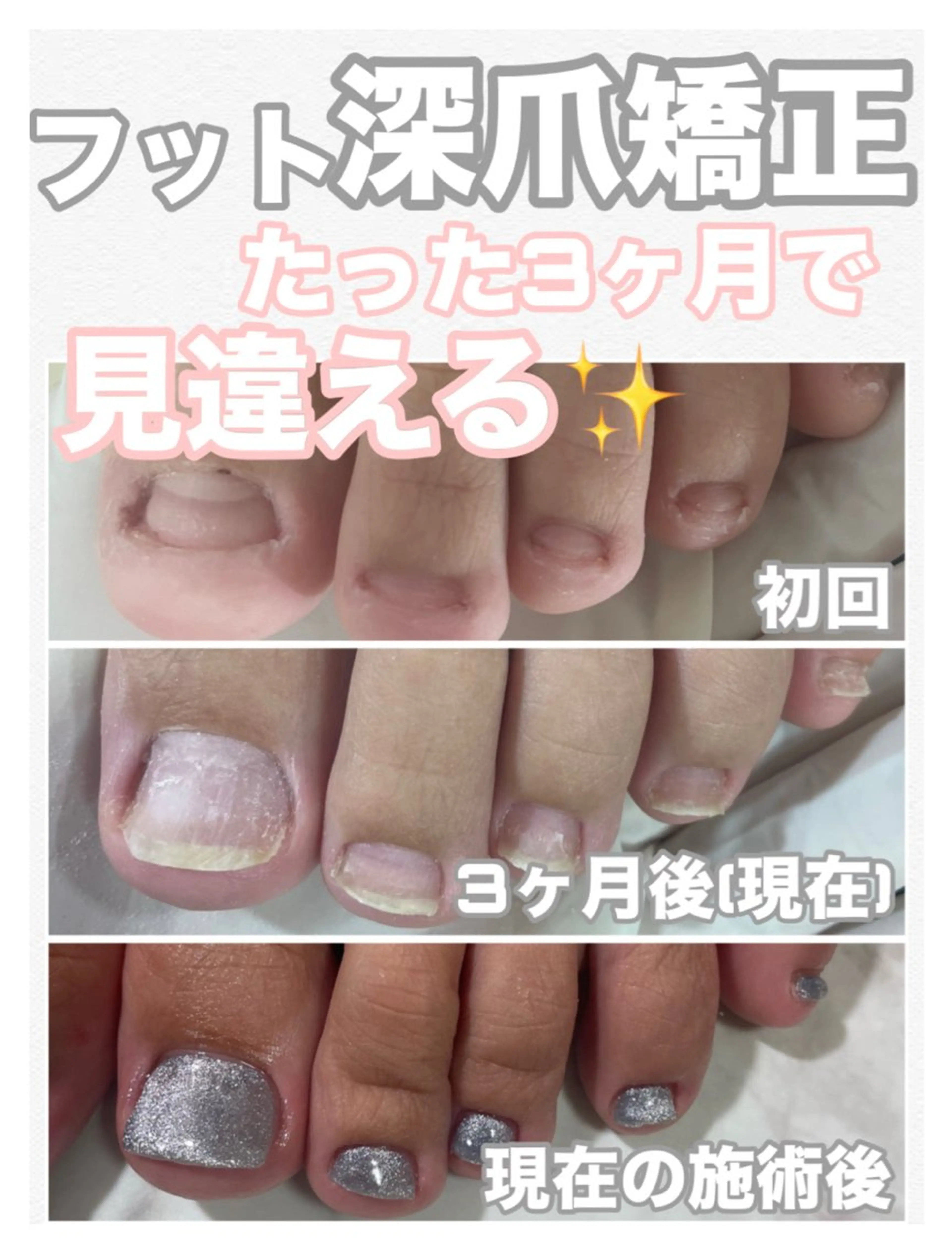 ネイル ブルー 長さ出し マグネットネイル フットネイル petillant所属・nail salon petillantのネイルデザイン