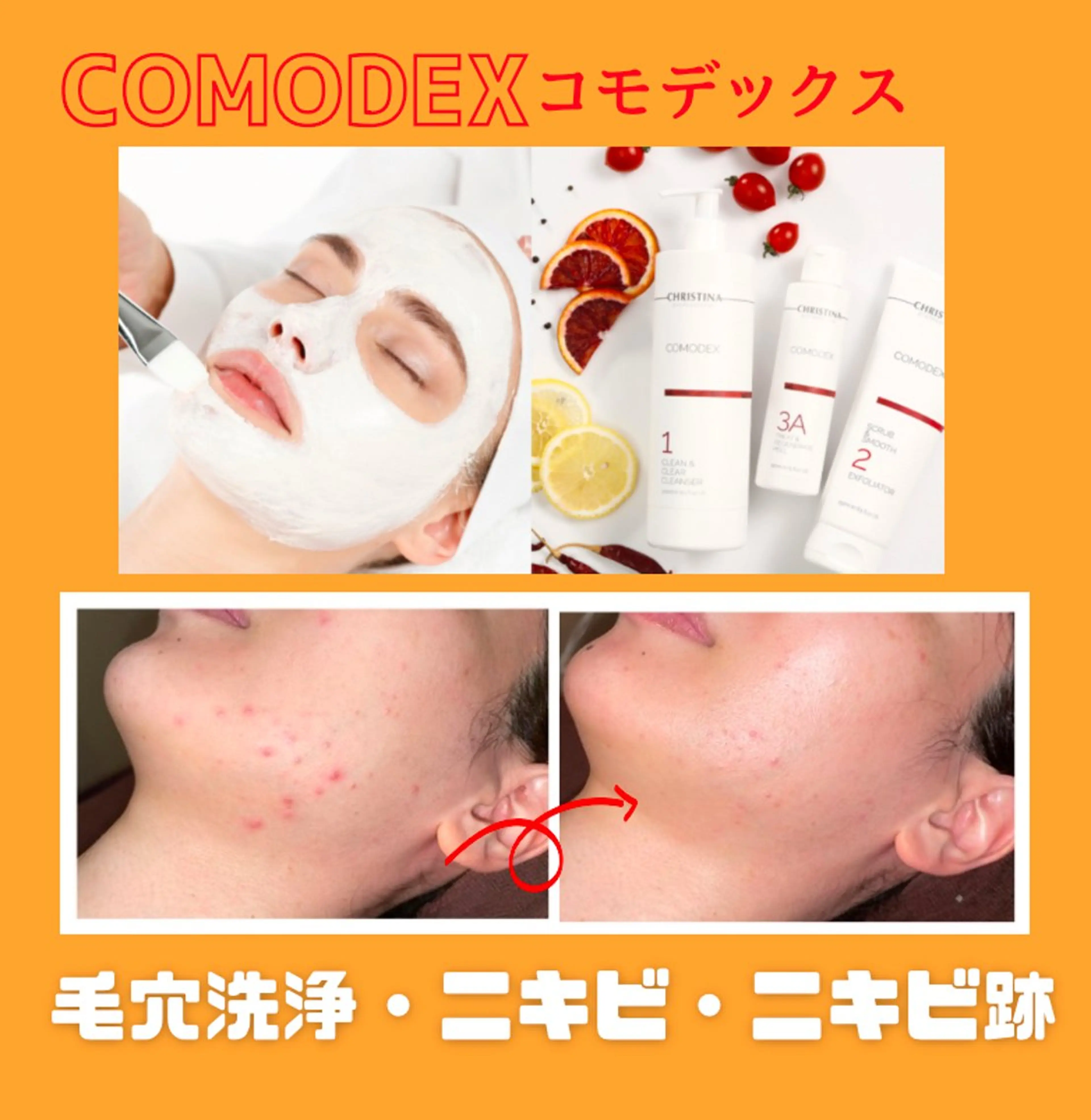 【クリスティーナ❤️コモデックス】今だけのミニモ限定価格！突然のニキビや繰り返すニキビにお悩みの方におすすめメニュー✨✨の写真