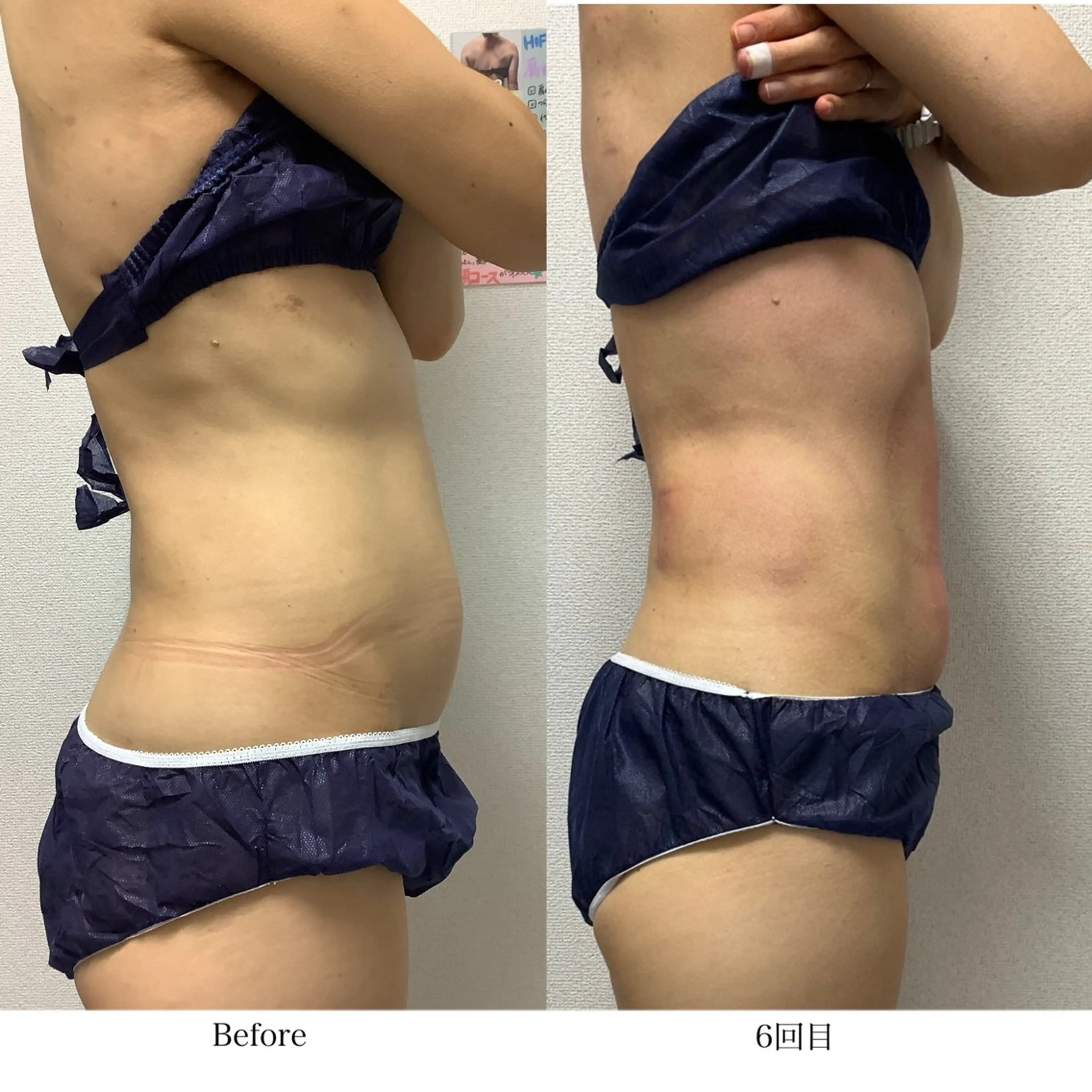 冷却専門店 SLARIのエステ・リラクイメージ