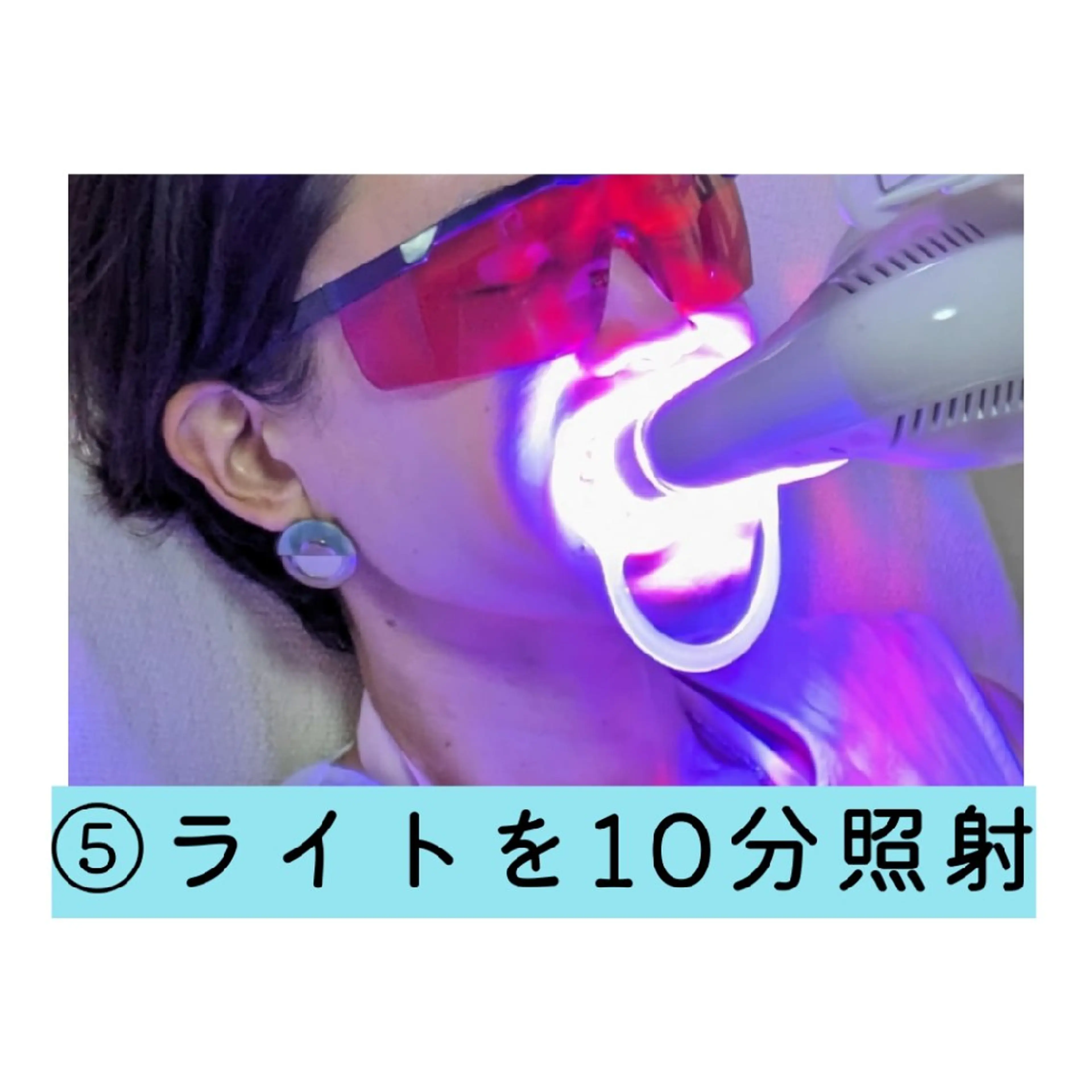 その他 ホワイトニングサロン ネージュ(女性専用)のその他イメージ
