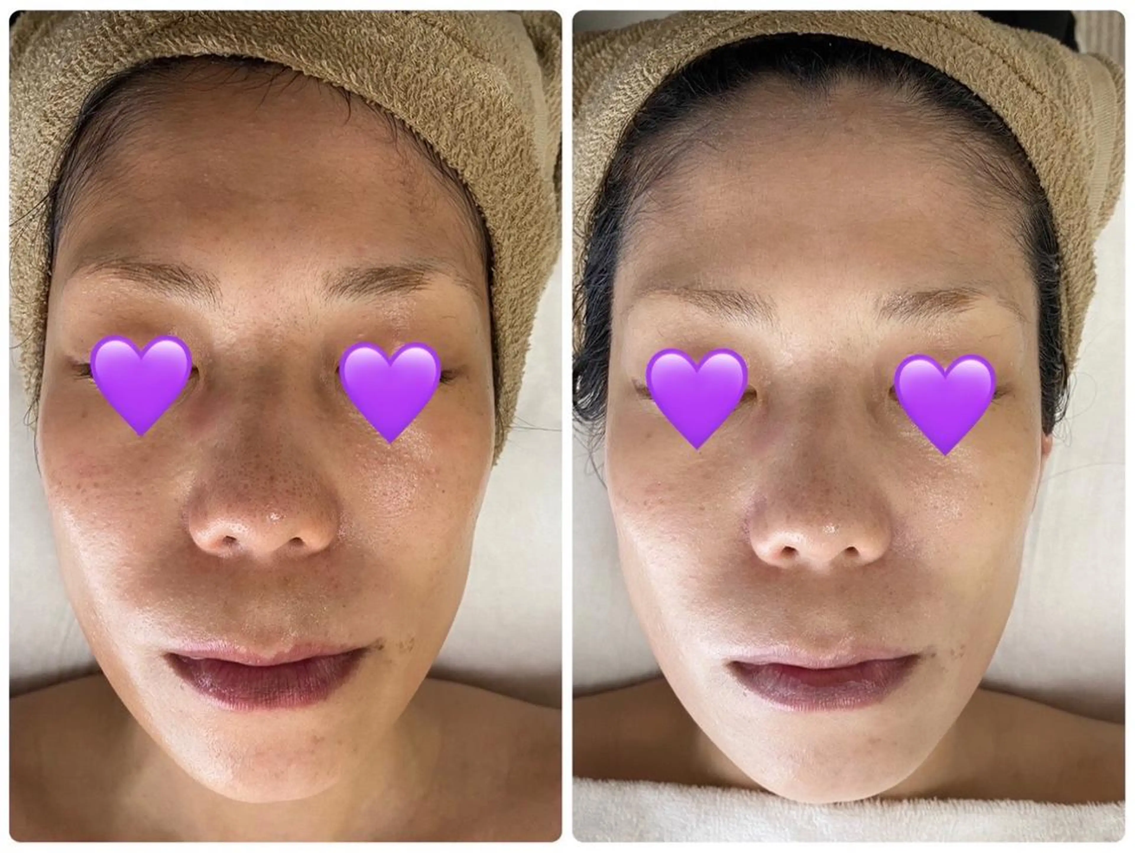 エステ De I'm トータルビューティーサロン所属・COCO beautyサロンのエステ・リラクイメージ