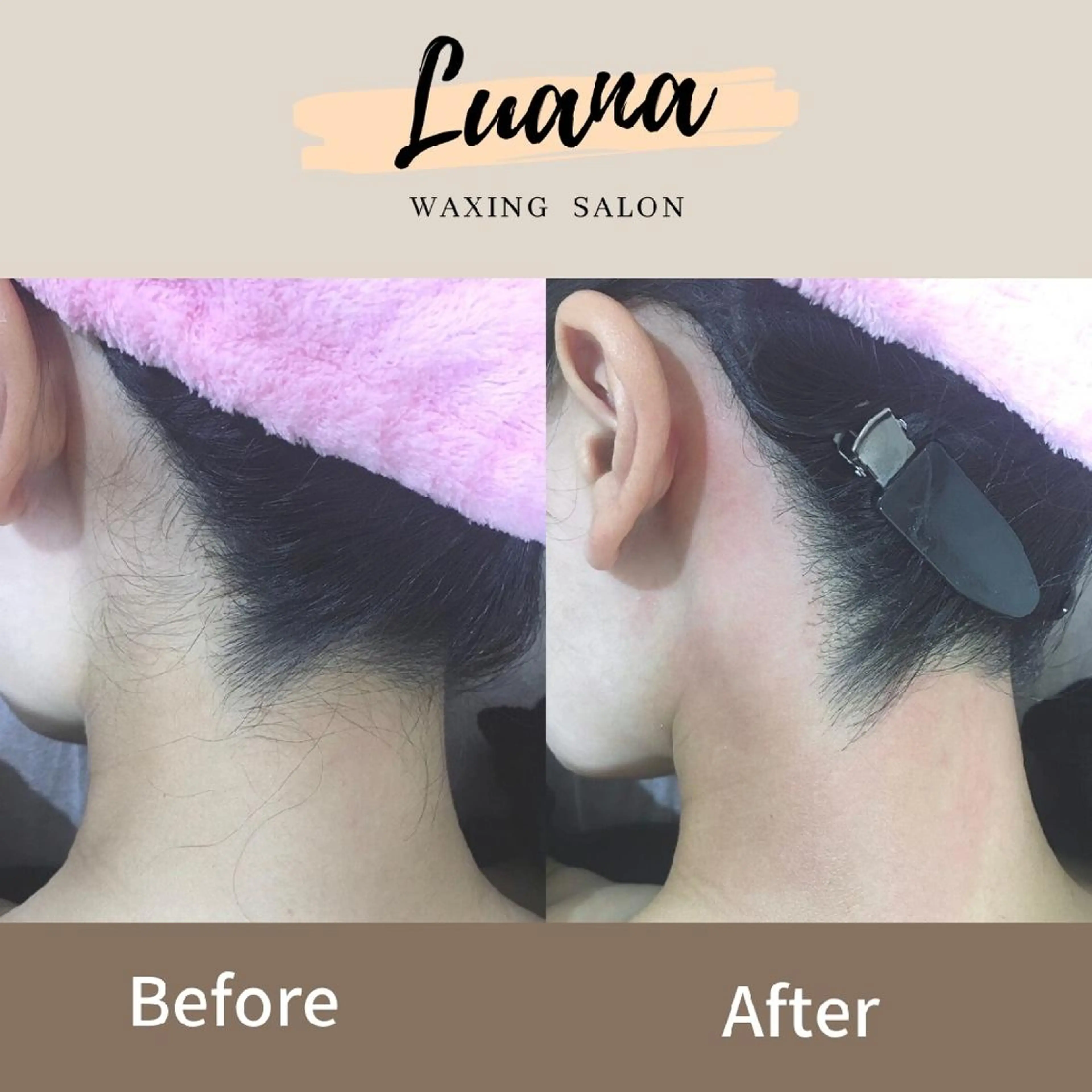 脱毛 Luana waxing salon所属・Luana wax 🐚根本のエステ・リラクイメージ