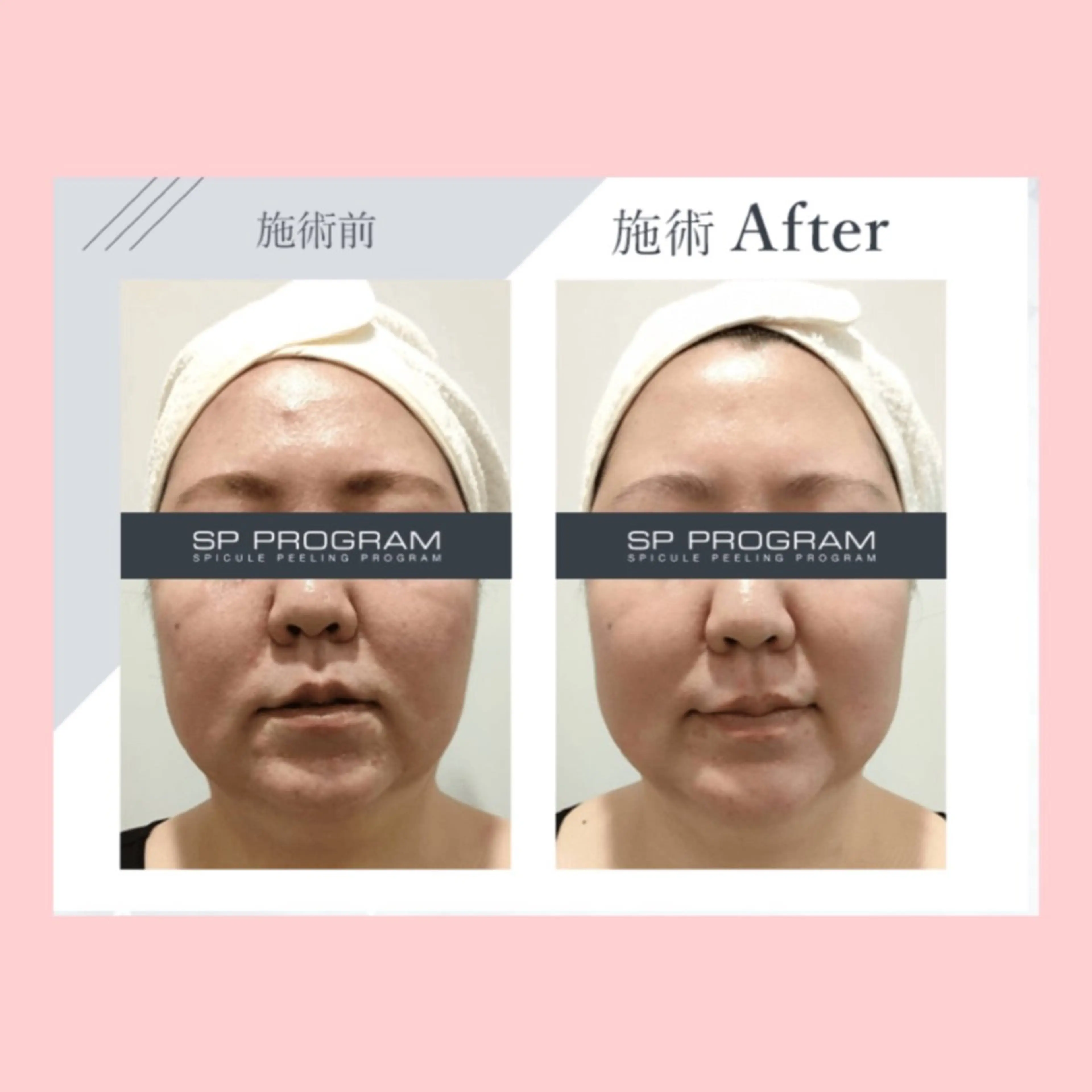 その他 Palum Airiのエステ・リラクイメージ
