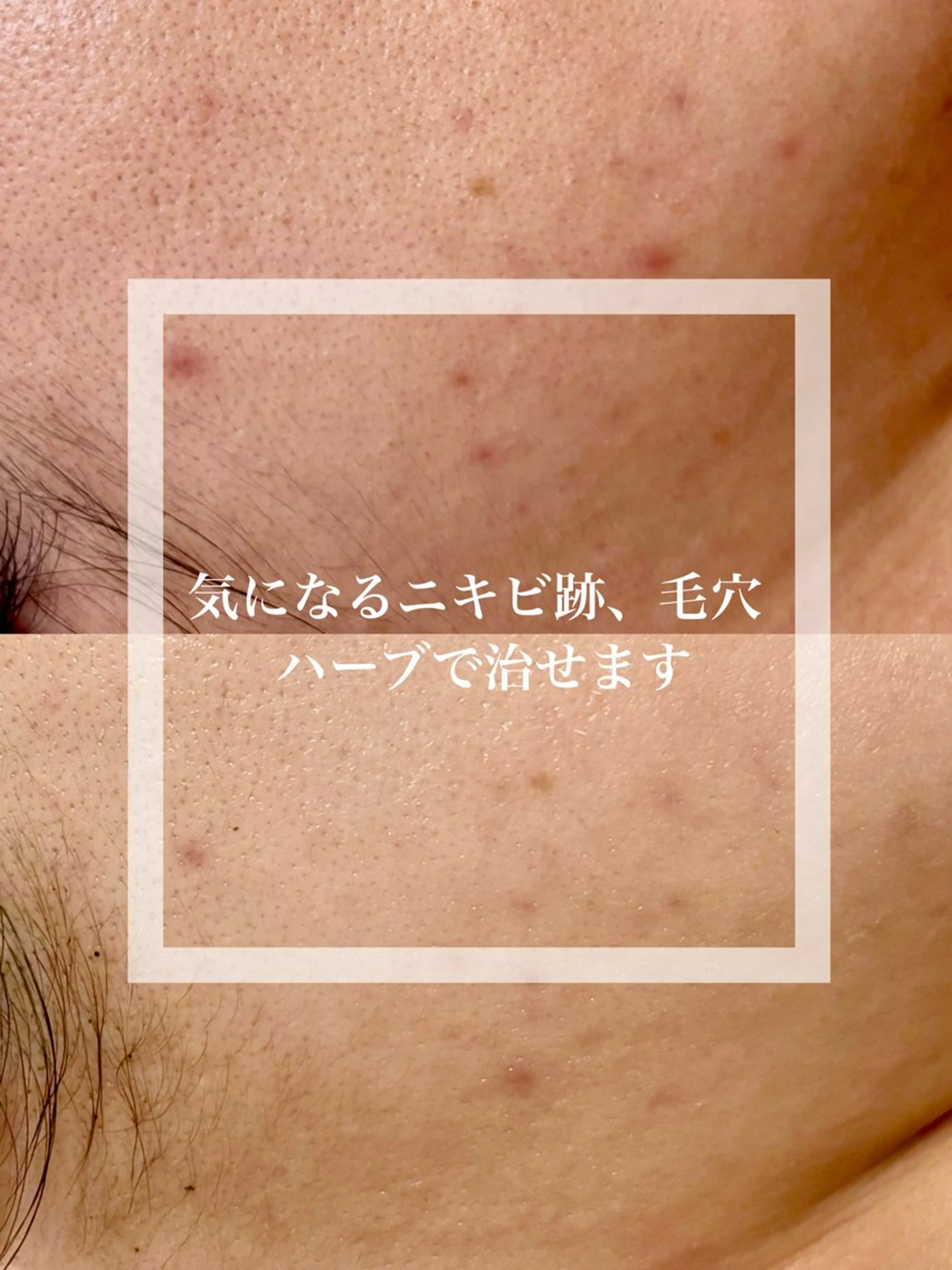 WHITE AQUA 北千住店のエステ・リラクイメージ