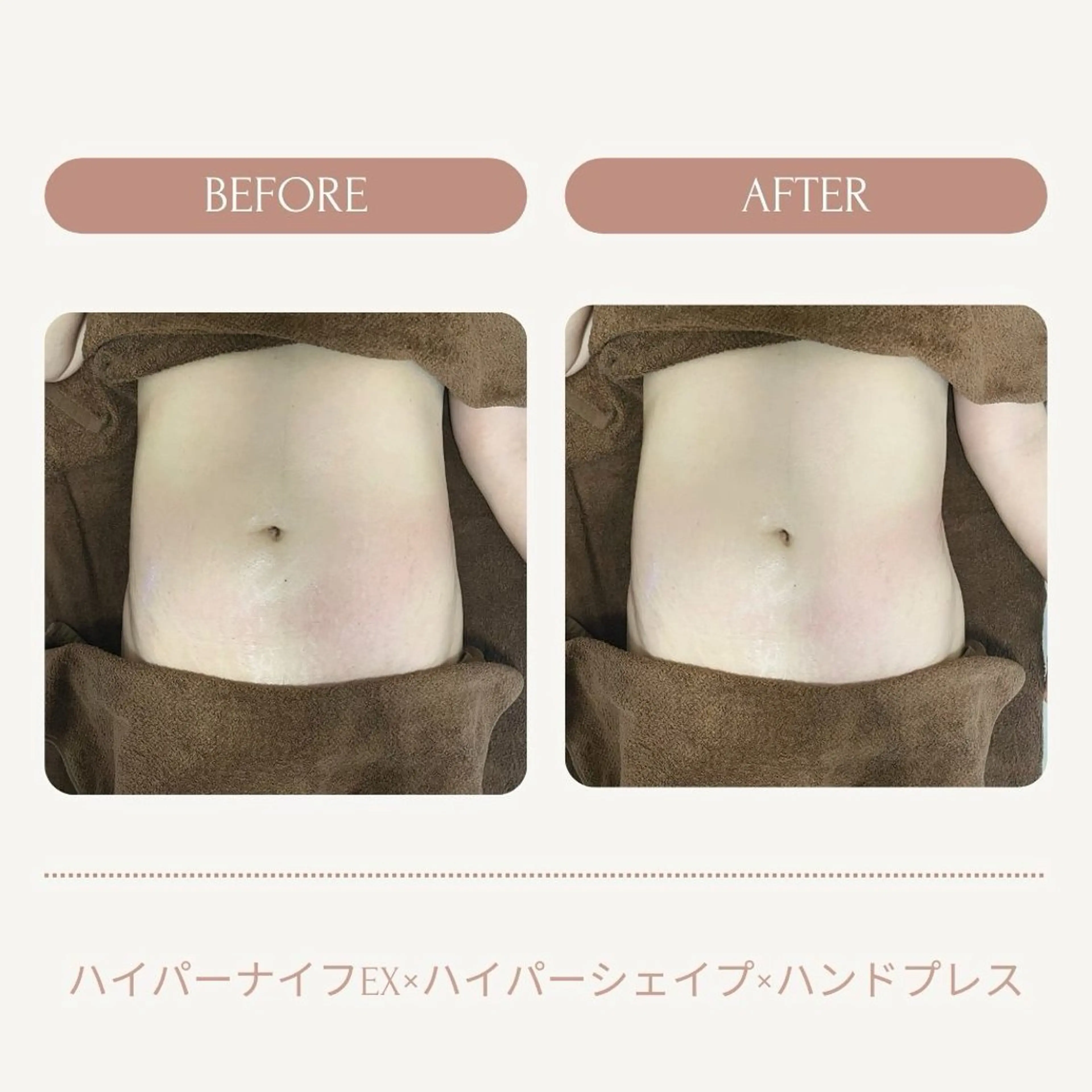 【メンズ限定★お腹集中ケア60分】固い贅肉&ぽっこりお腹/内蔵脂肪徹底改善！の写真