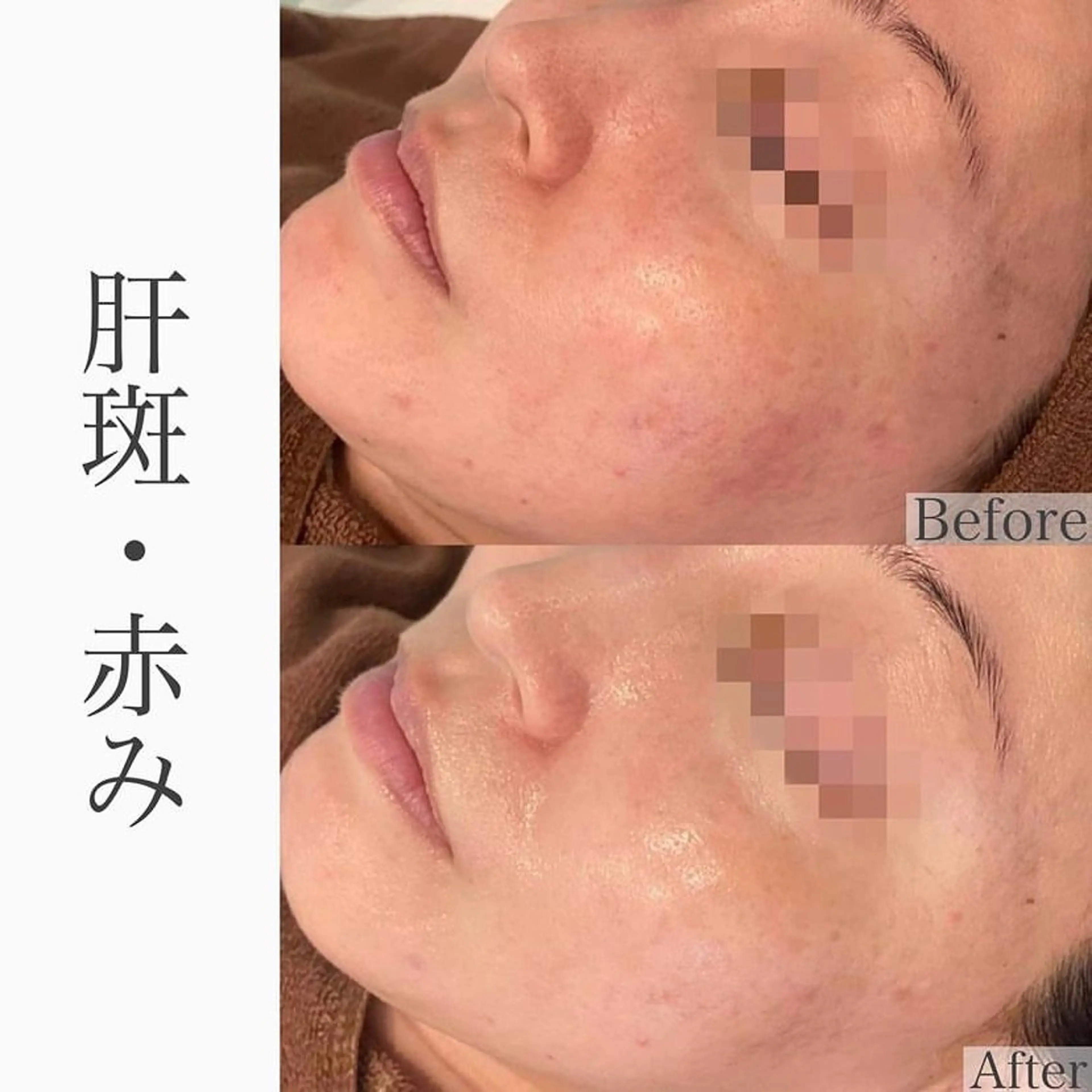 ハーブピーリング専門 BIOEL横浜のエステ・リラクイメージ