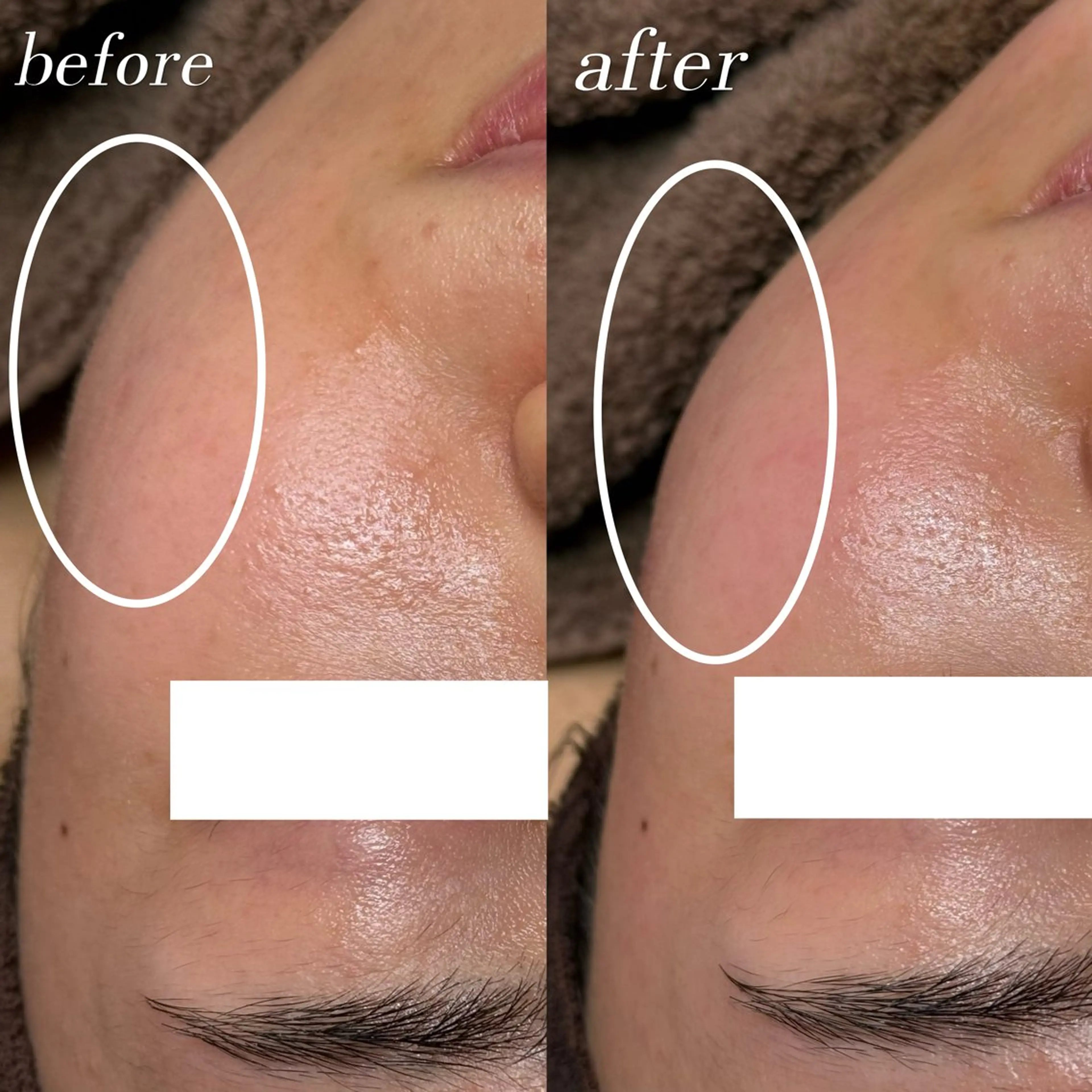 脱毛 長野 美里のエステ・リラクイメージ