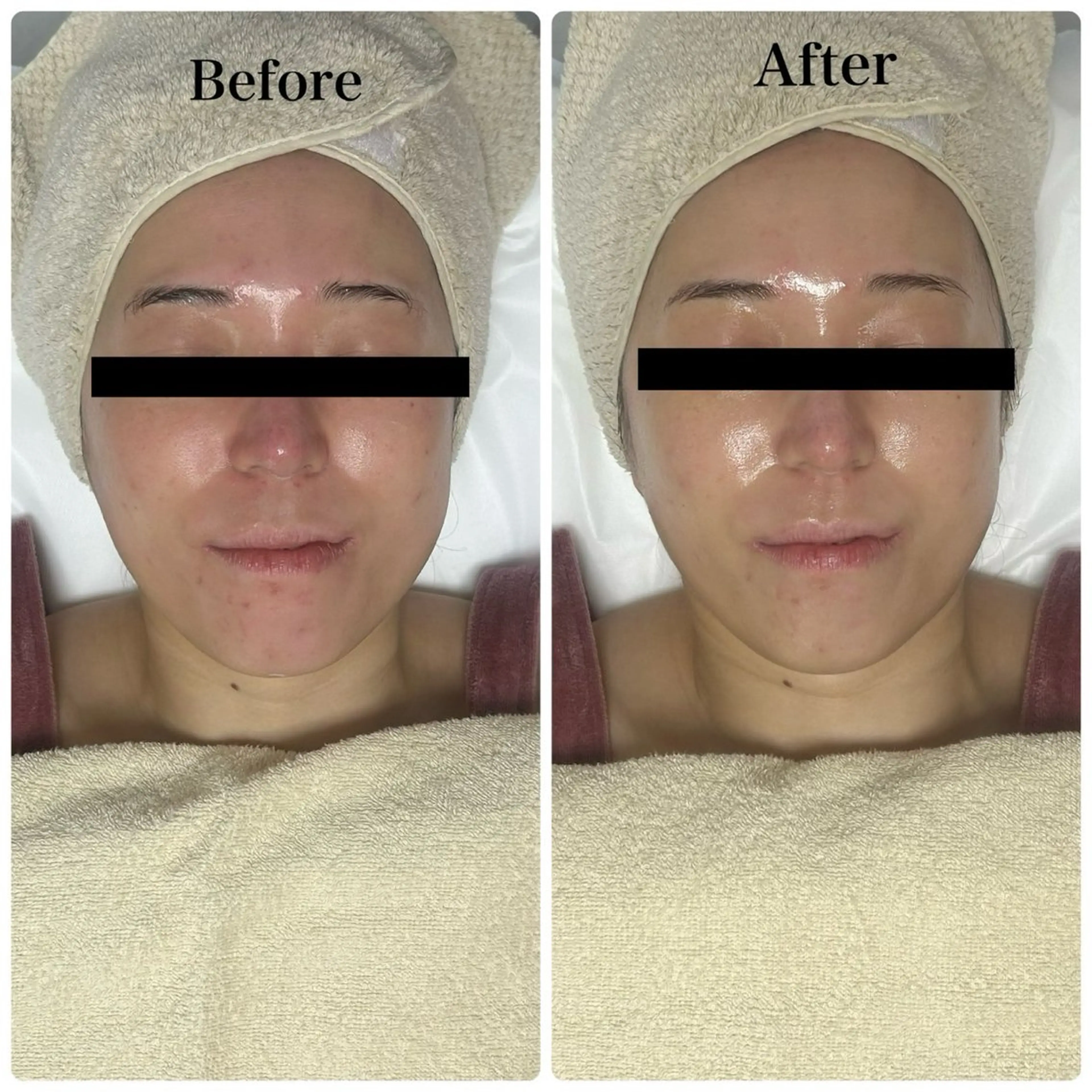 エステ リラク 脱毛サロン エクボ 高瀬のエステ・リラクイメージ