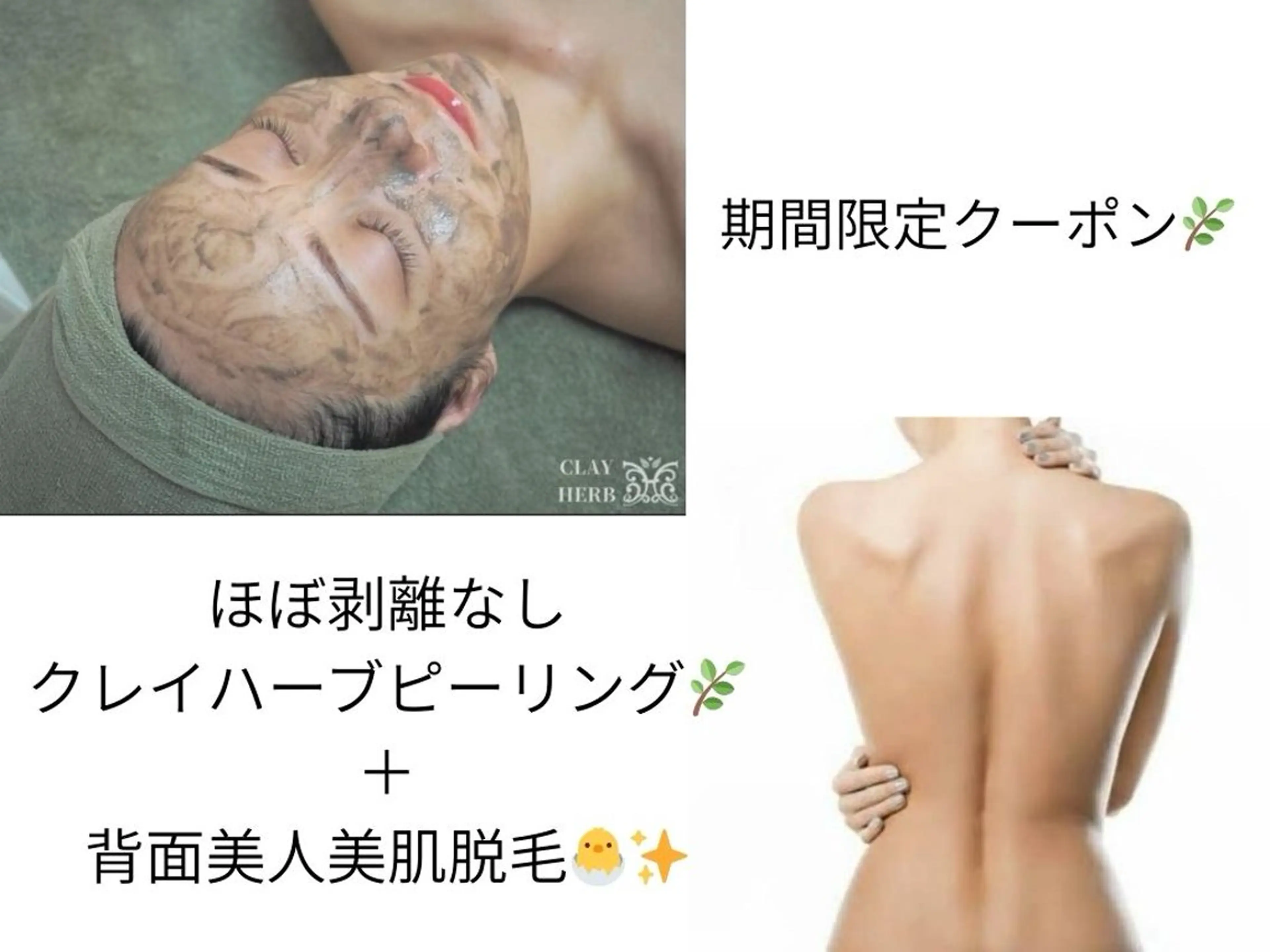 【9月限定】背面脱毛+ほぼ剥離なしクレイハーブピーリング18,000円→15,000円の写真