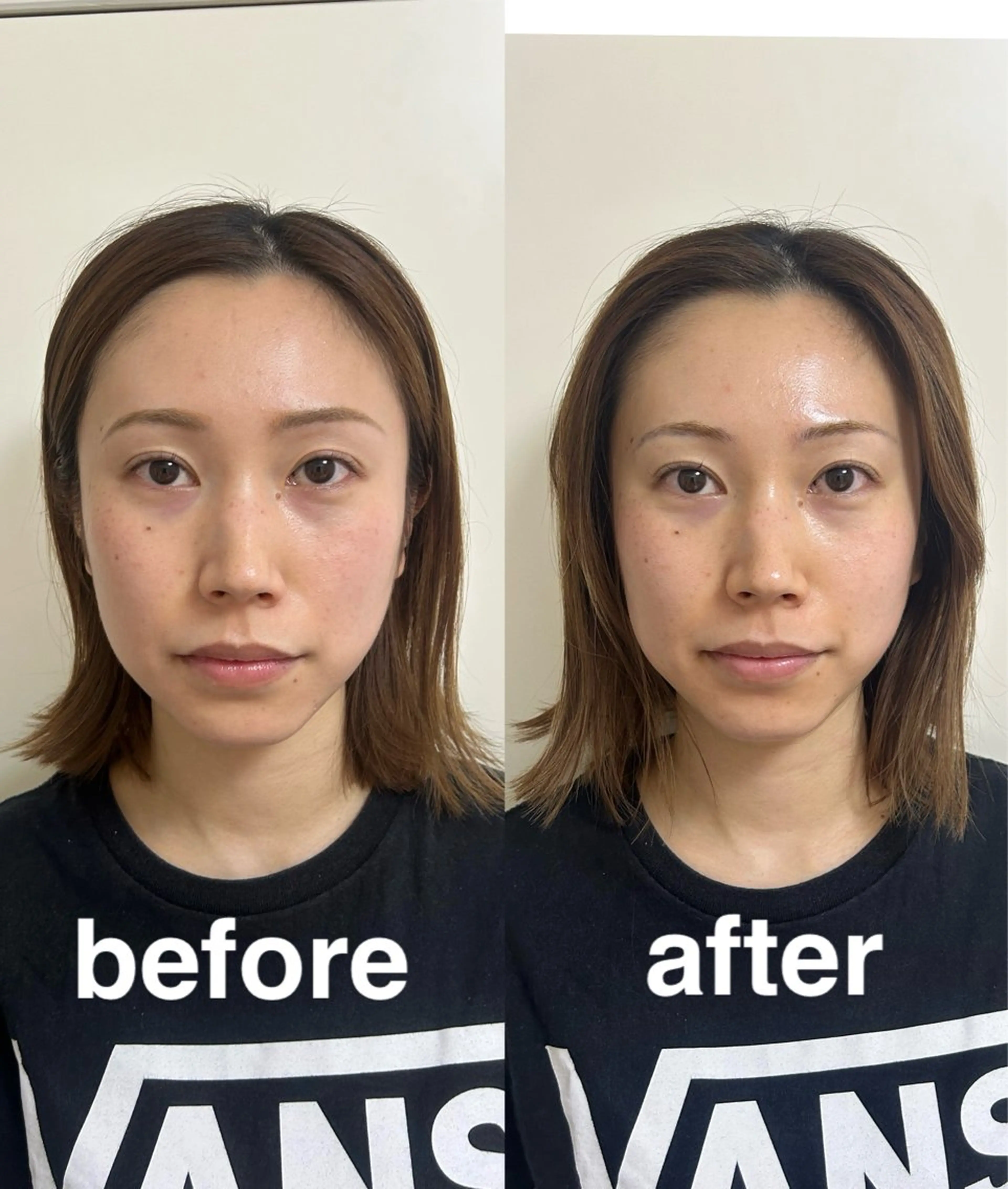 美容鍼灸サロン mahoroba院長のエステ・リラクイメージ