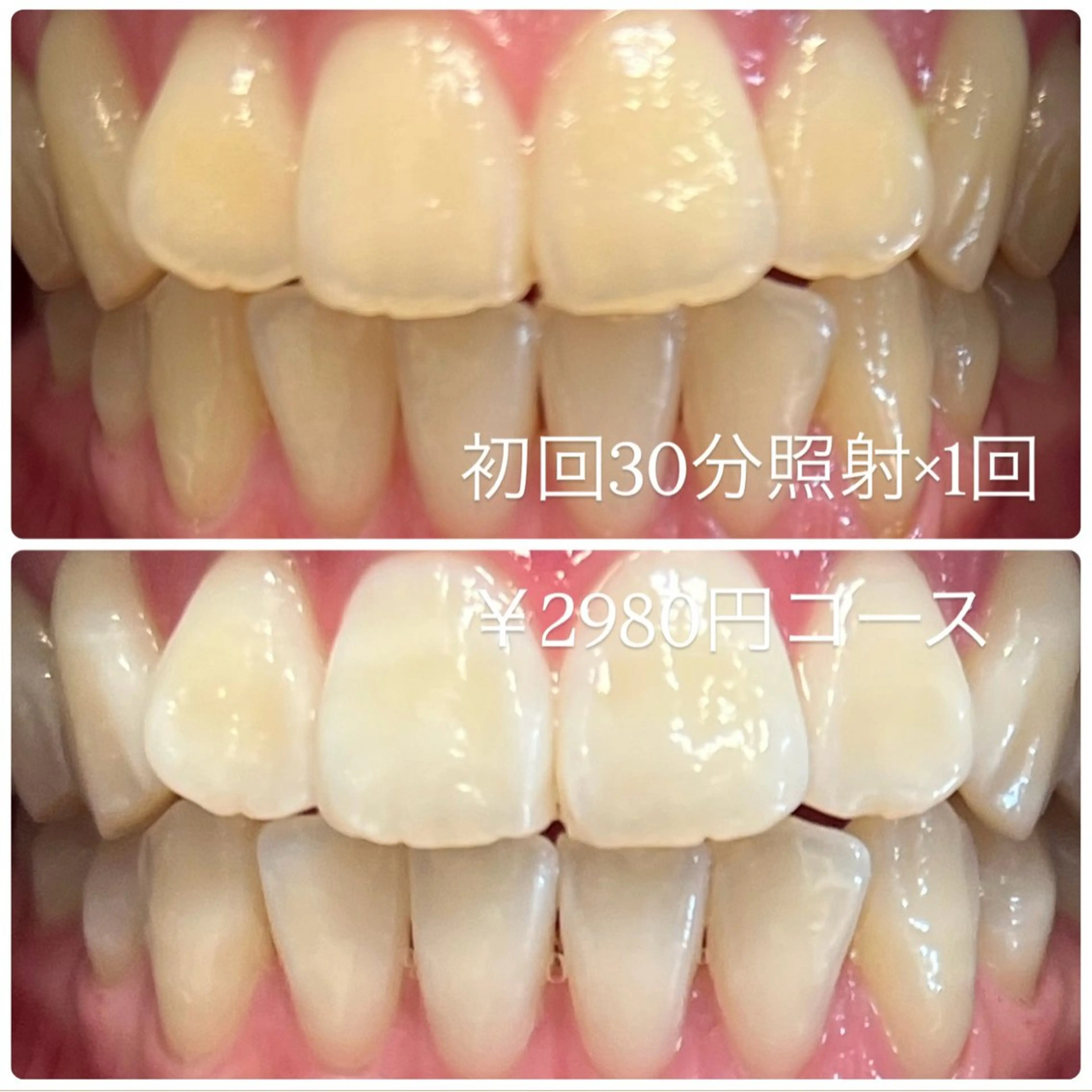 その他 PLATINUM Beauty 横浜店所属・ホワイトニングルーム 横浜店のその他イメージ