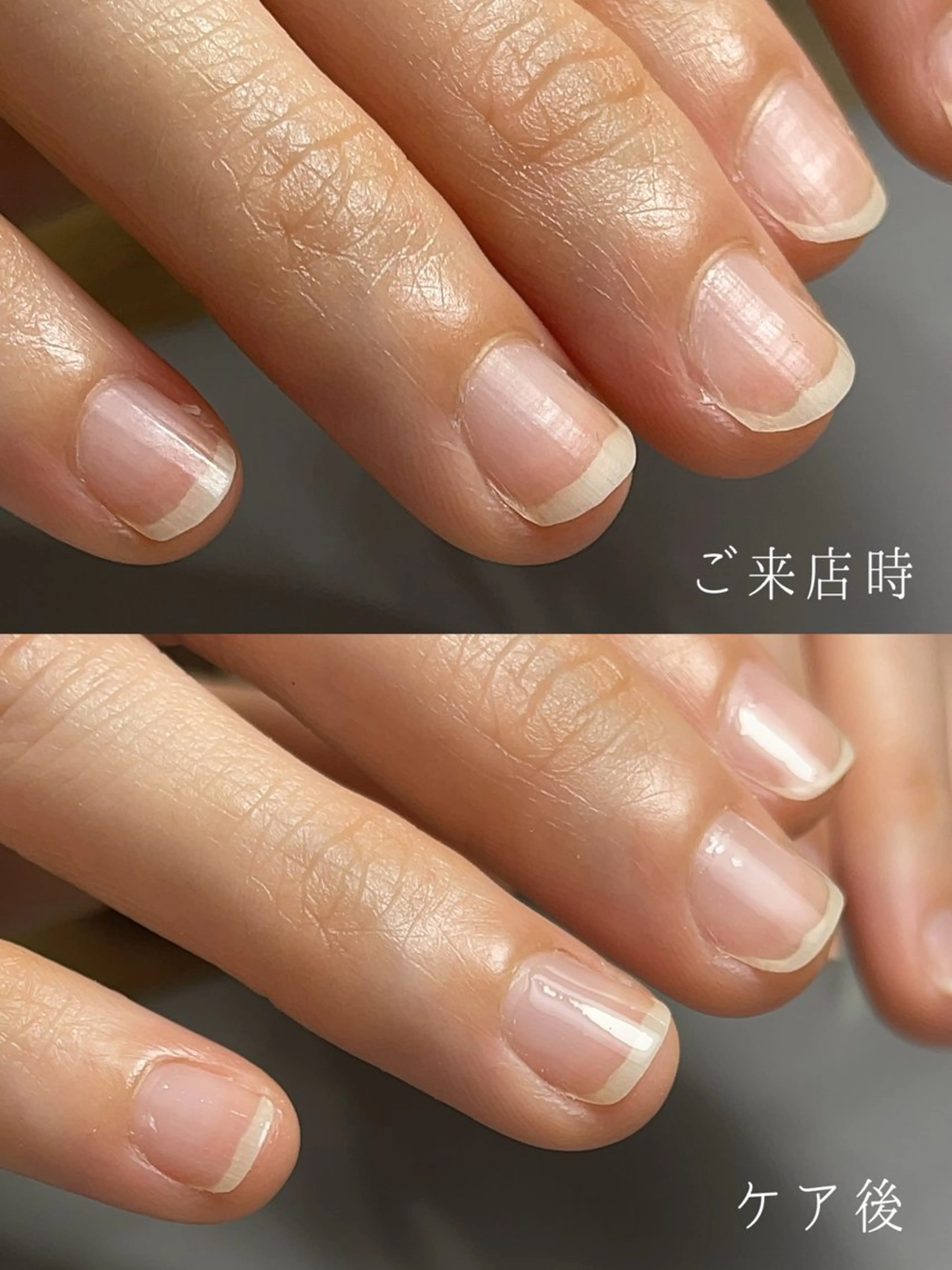 ショート その他(ネイル) Aim* 深爪・自爪育成専門店のネイルデザイン