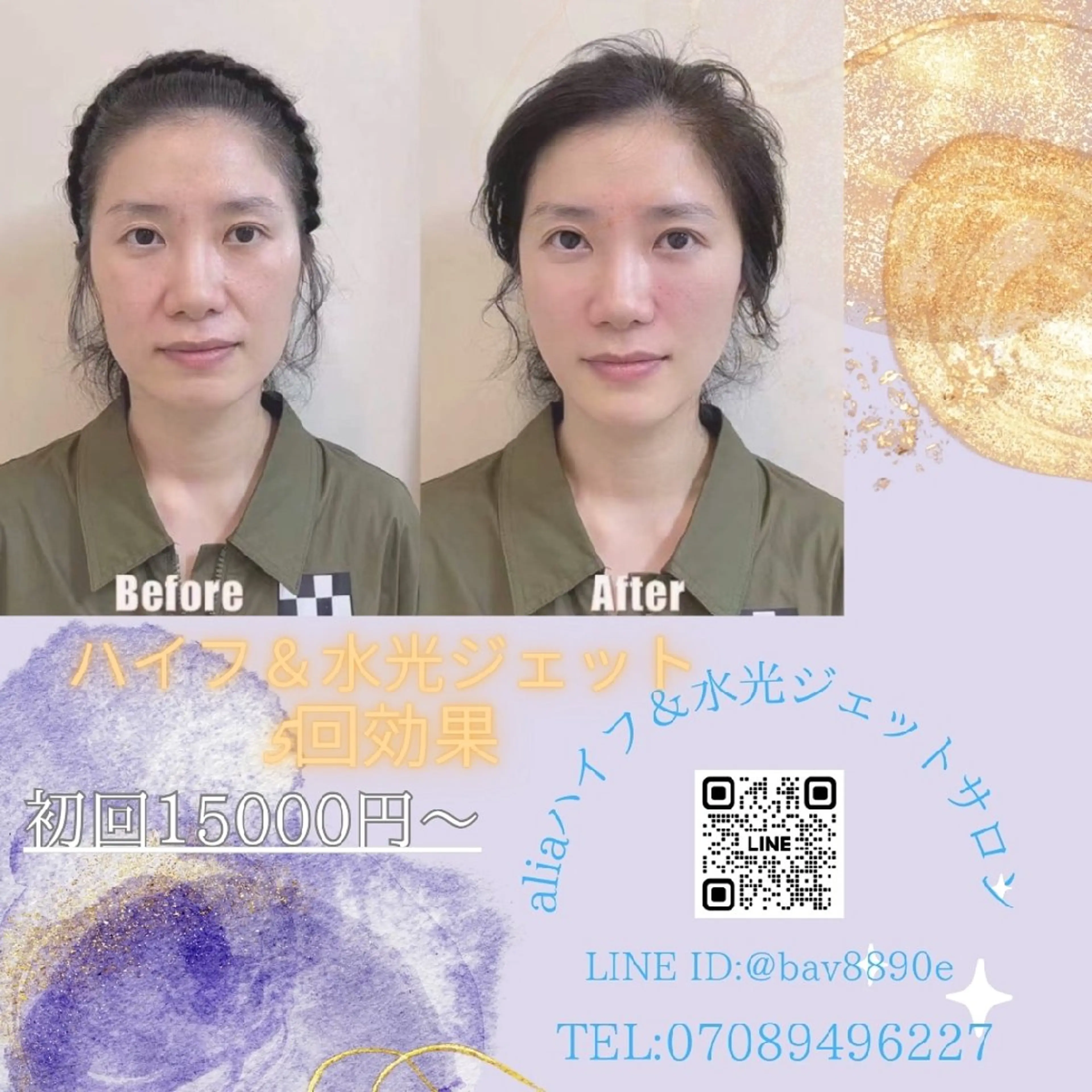 aliaハイフ&水光ジェットサロン所属・aliaハーブ水光店 エステティシャン募集のエステ・リラクイメージ