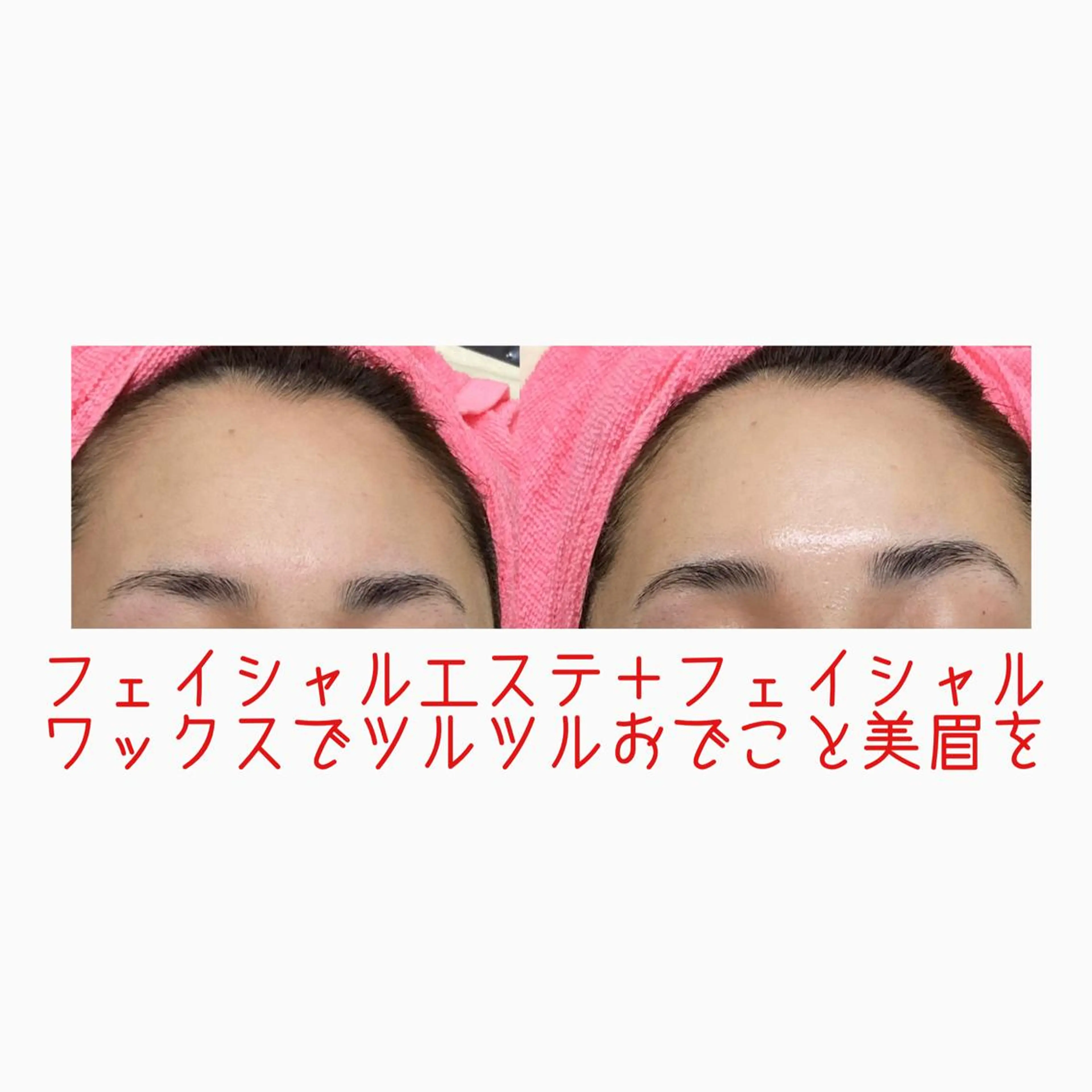 オアシス・さくら所属・中村貴子都度払い脱毛 小顔コルギのエステ・リラクイメージ