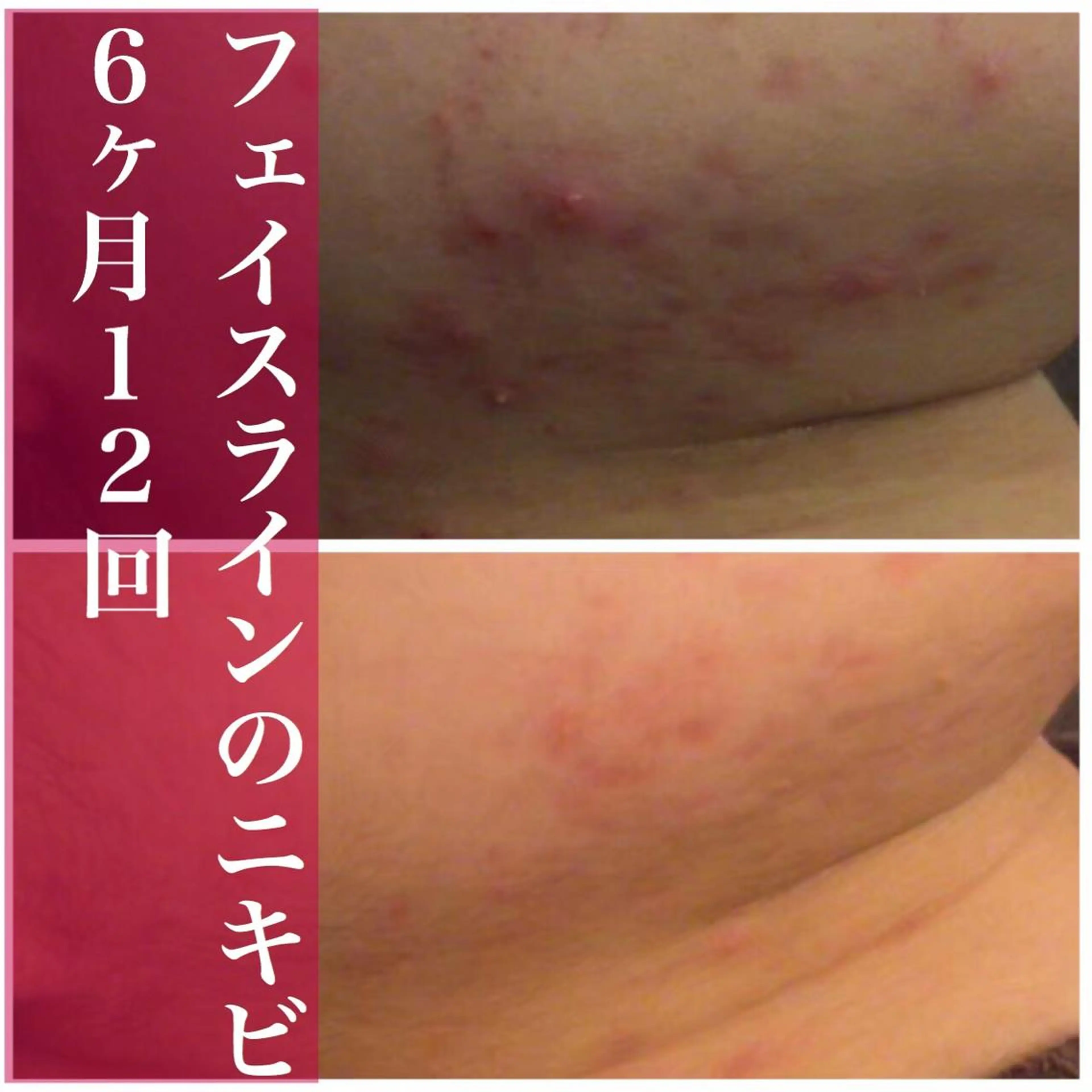 ミディアム カラー パーマ ヘアアレンジ メンズ キッズ ネイル マツエク・マツパ アイブロウ エステ リラク アクール　齋藤 ♡肌トラブル卒業のエステ・リラクイメージ