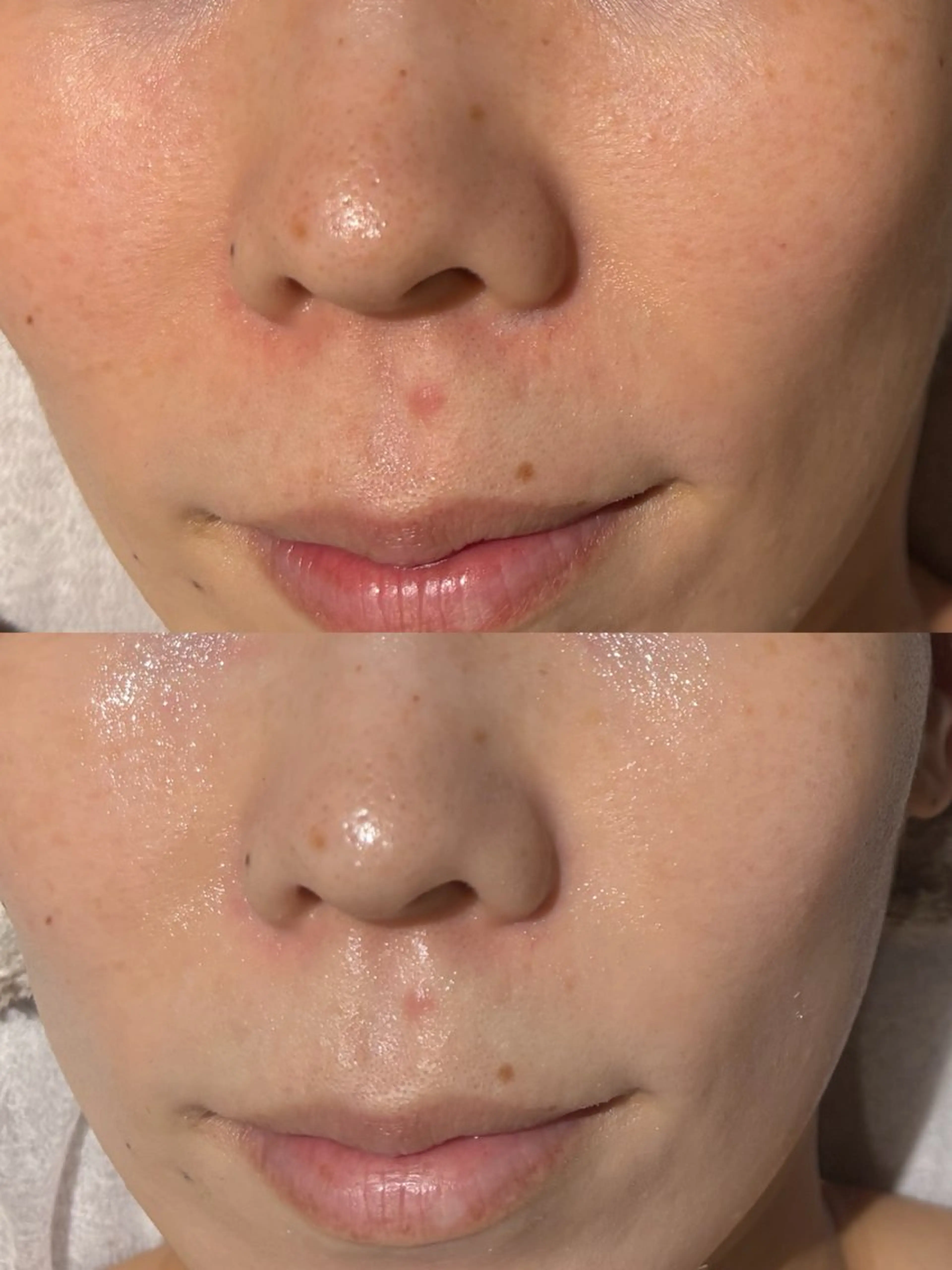 /ulu  soin所属・太田 玲奈のエステ・リラクイメージ