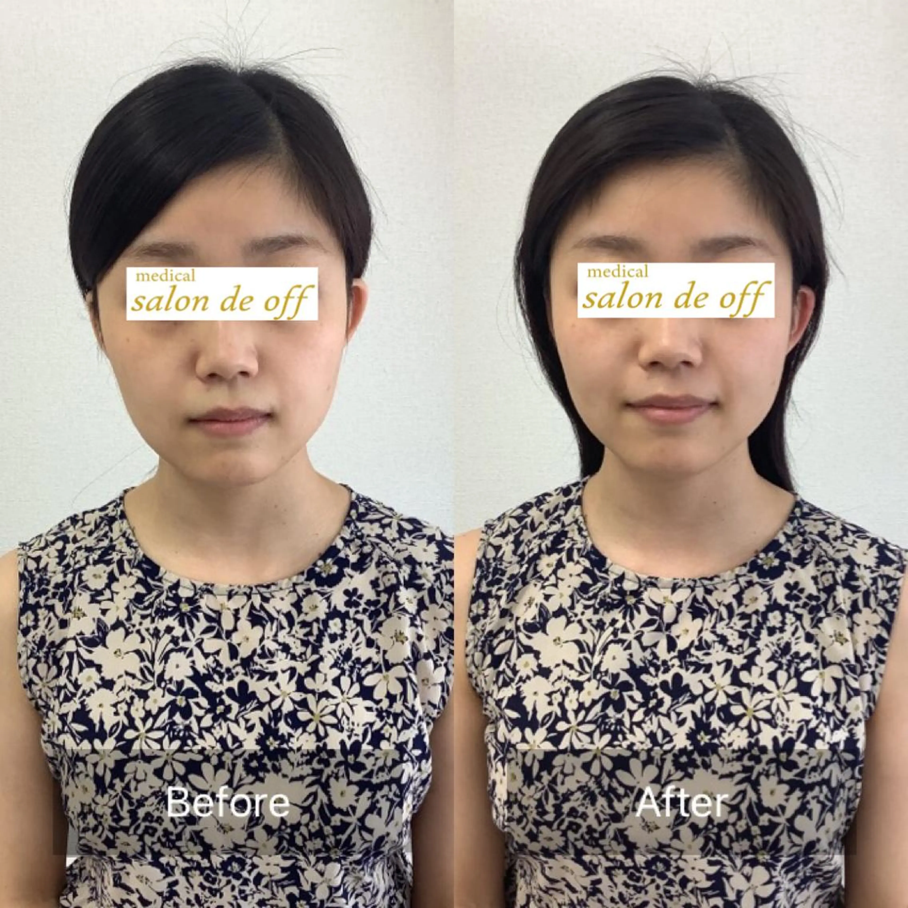 エステ リラク メディカルサロンドオフ所属・ハリサロンドオフ 美容鍼灸×小顔整体のエステ・リラクイメージ