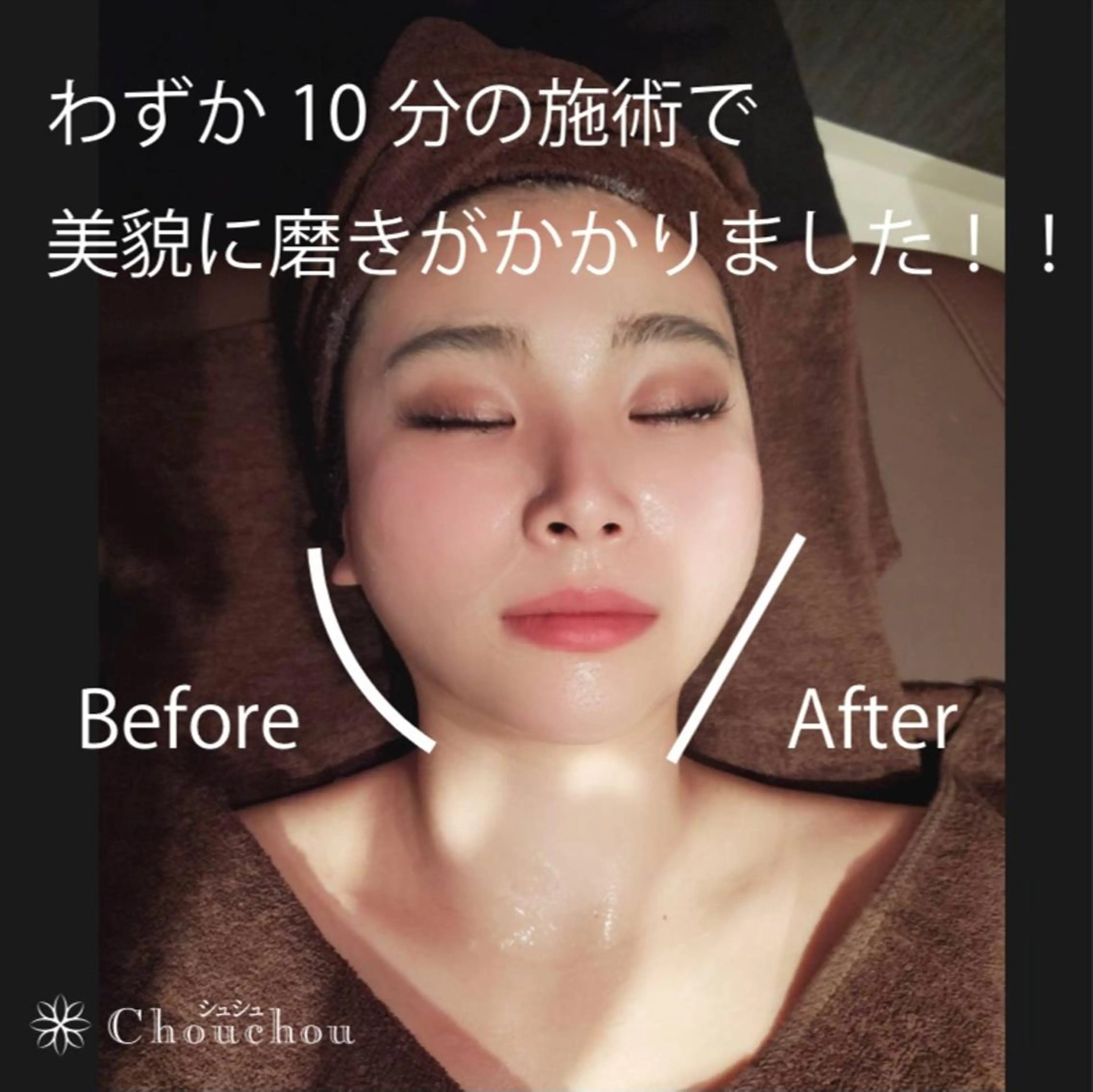 痩身・小顔・美肌専門 Chou chouのエステ・リラクイメージ