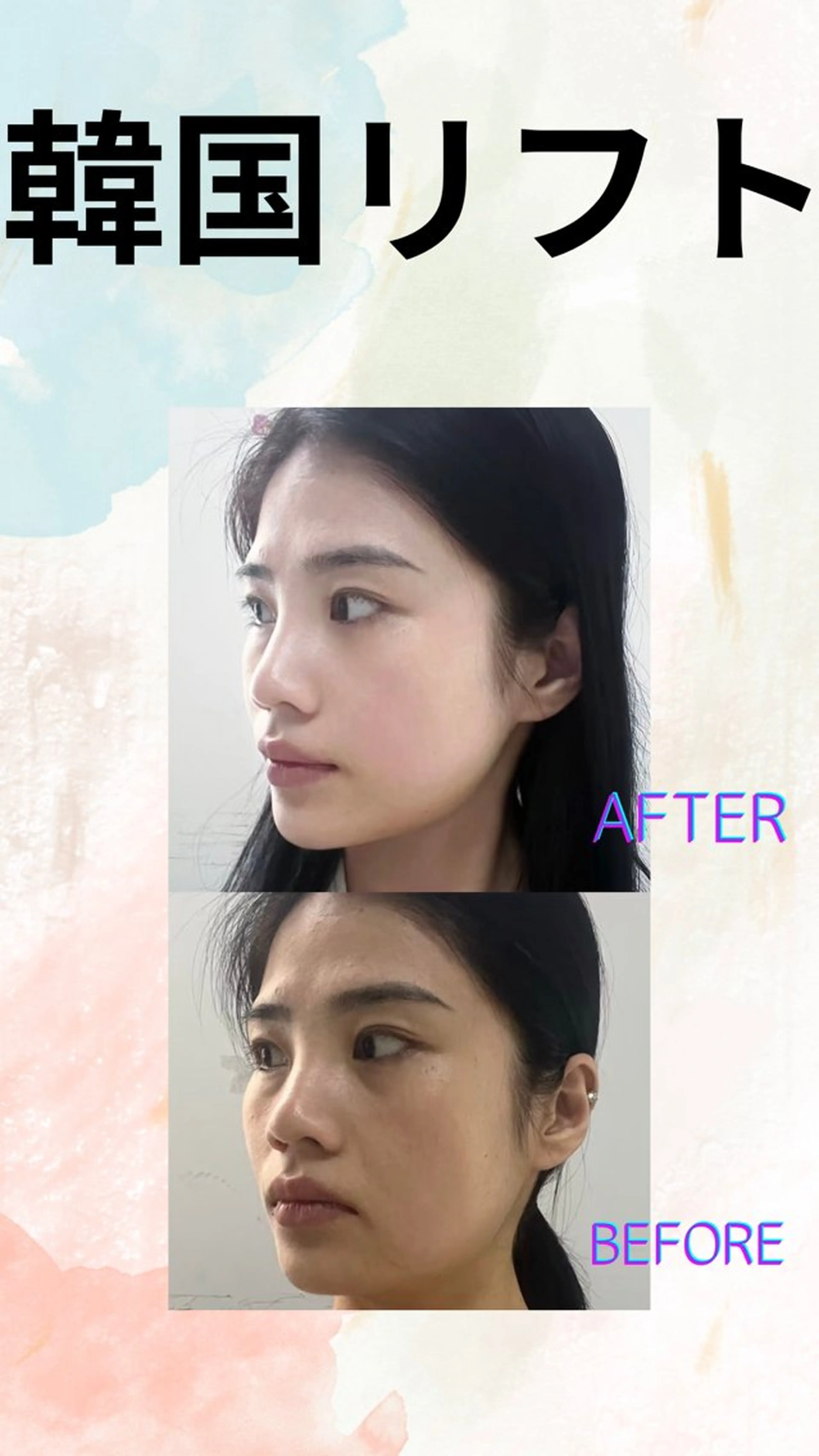 ショート エステ 愛維美水光美肌専門店所属・愛維美水光美肌専門店 メンズレディースokのエステ・リラクイメージ