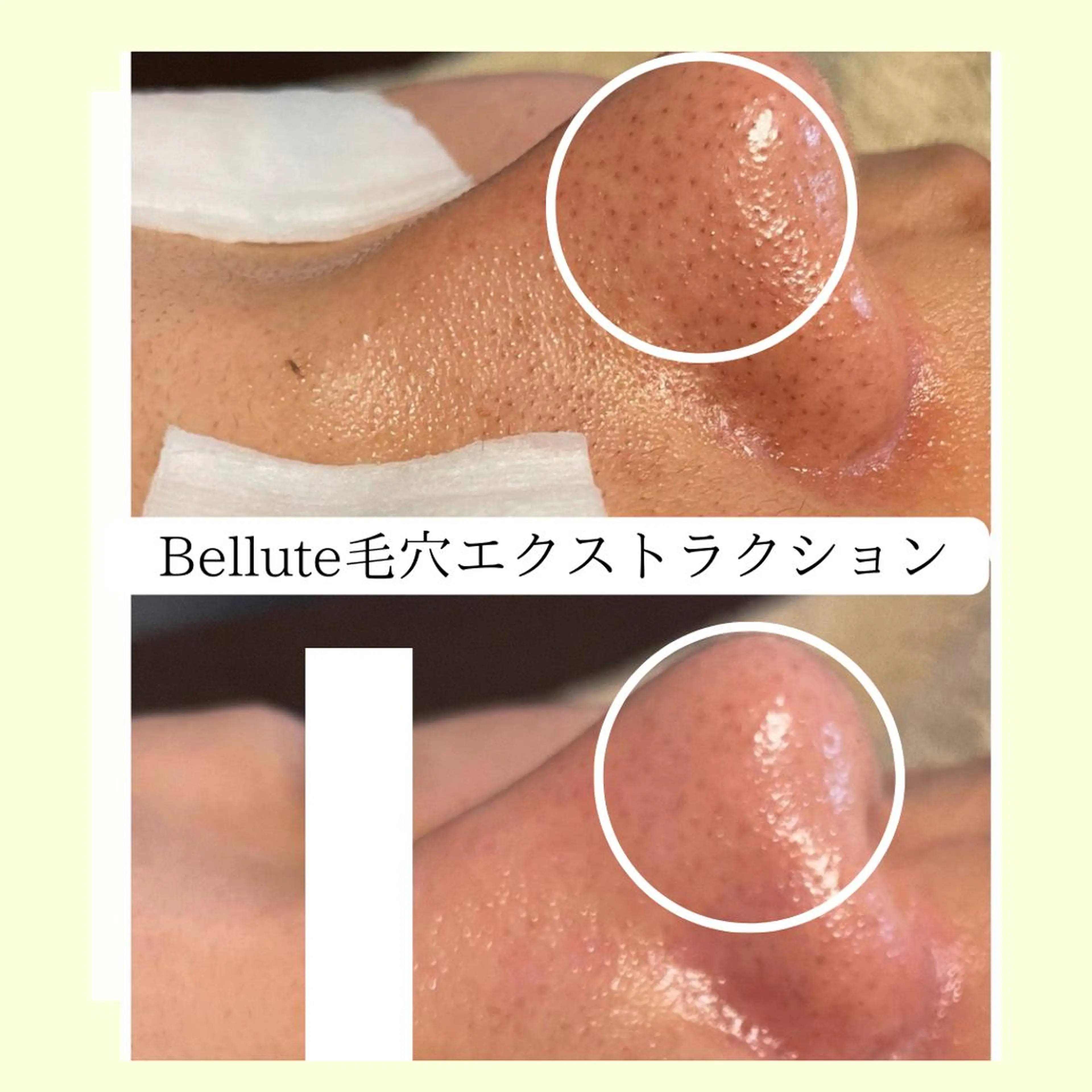 エステ リラク ピーリング専門店 Belluteのエステ・リラクイメージ