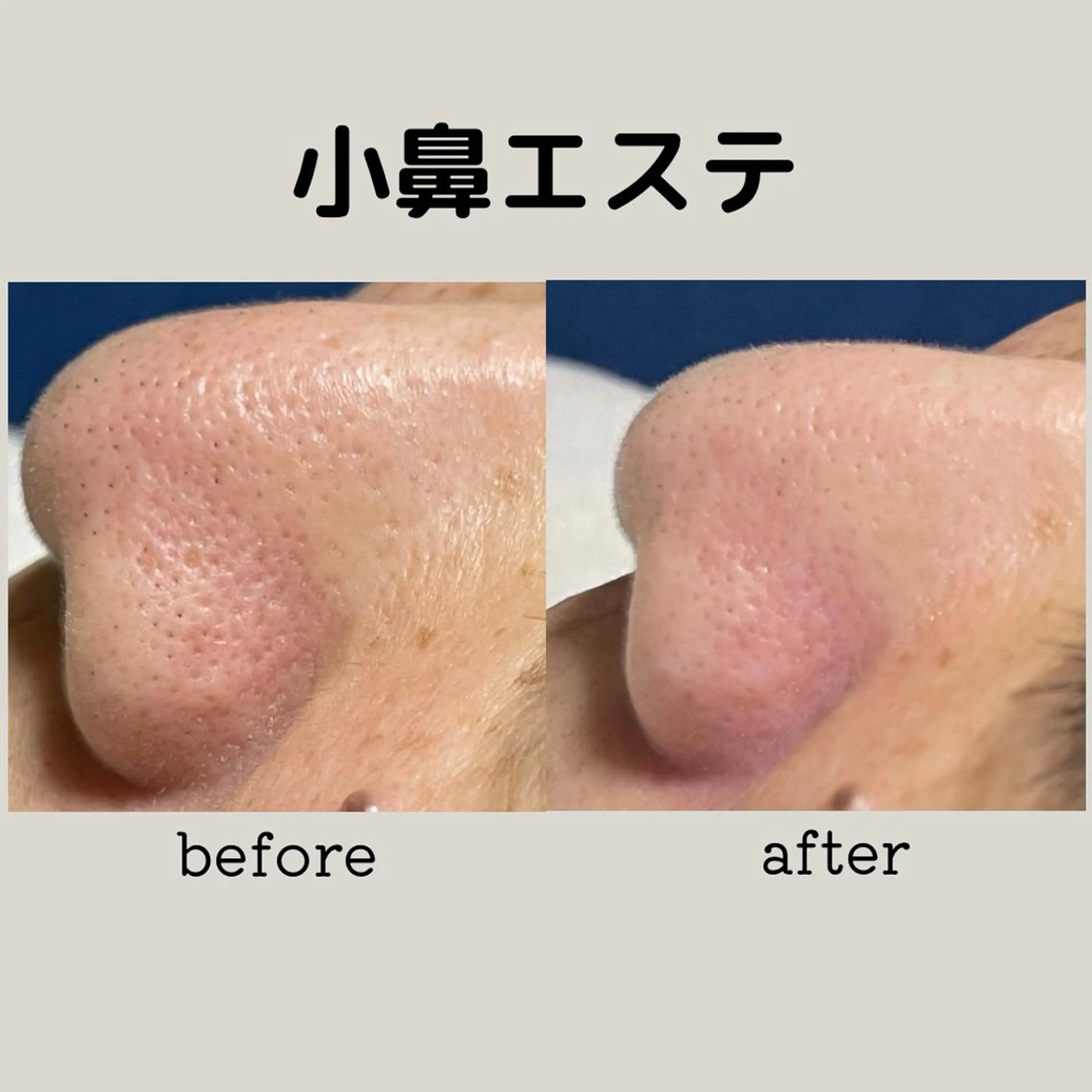 エステ DeI'm   名古屋栄所属・小林 玲菜のエステ・リラクイメージ