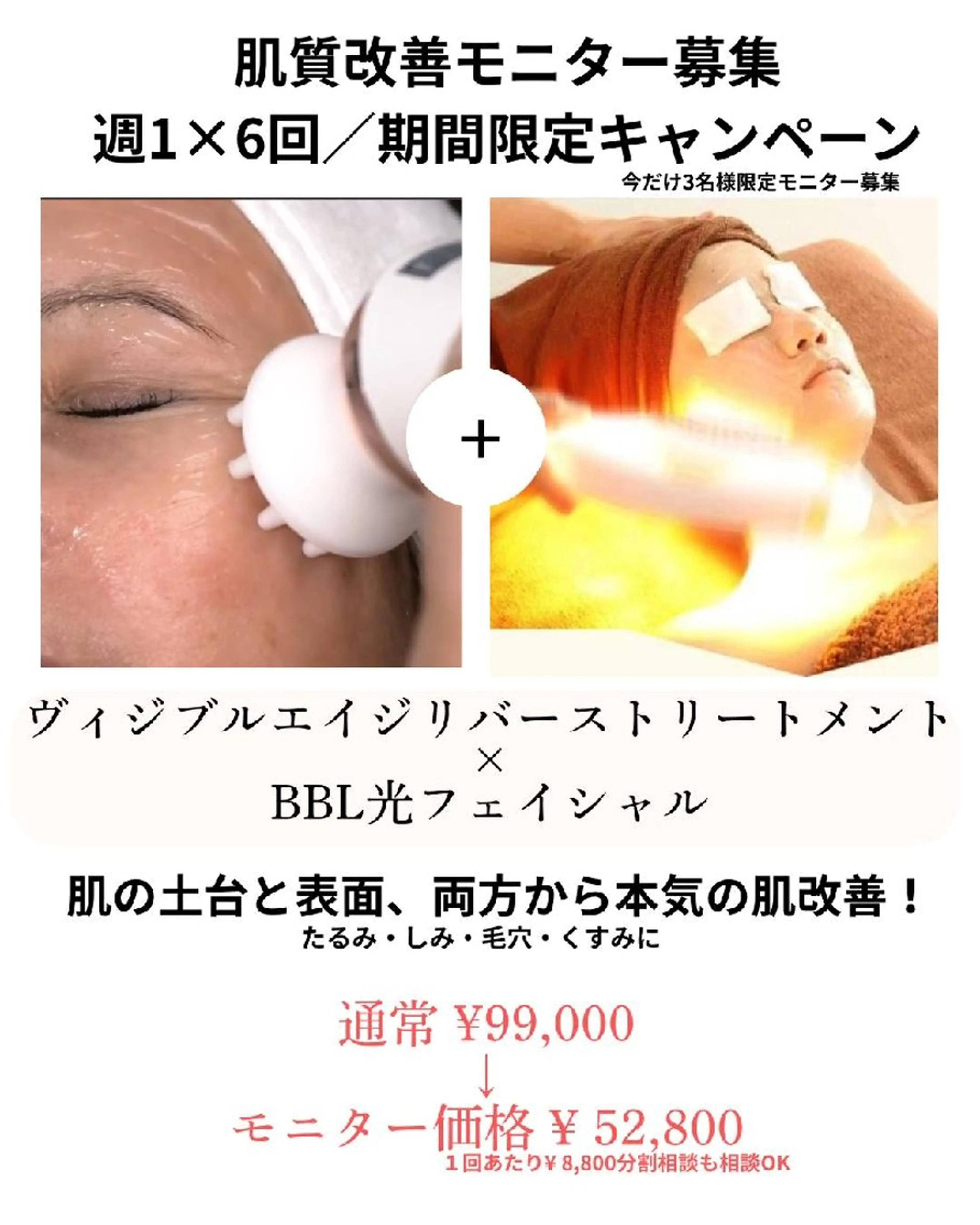 【6回モニター募集】肌質改善×たるみケア◎ヴィジブル×BBLで本気のエイジングケア✨の写真