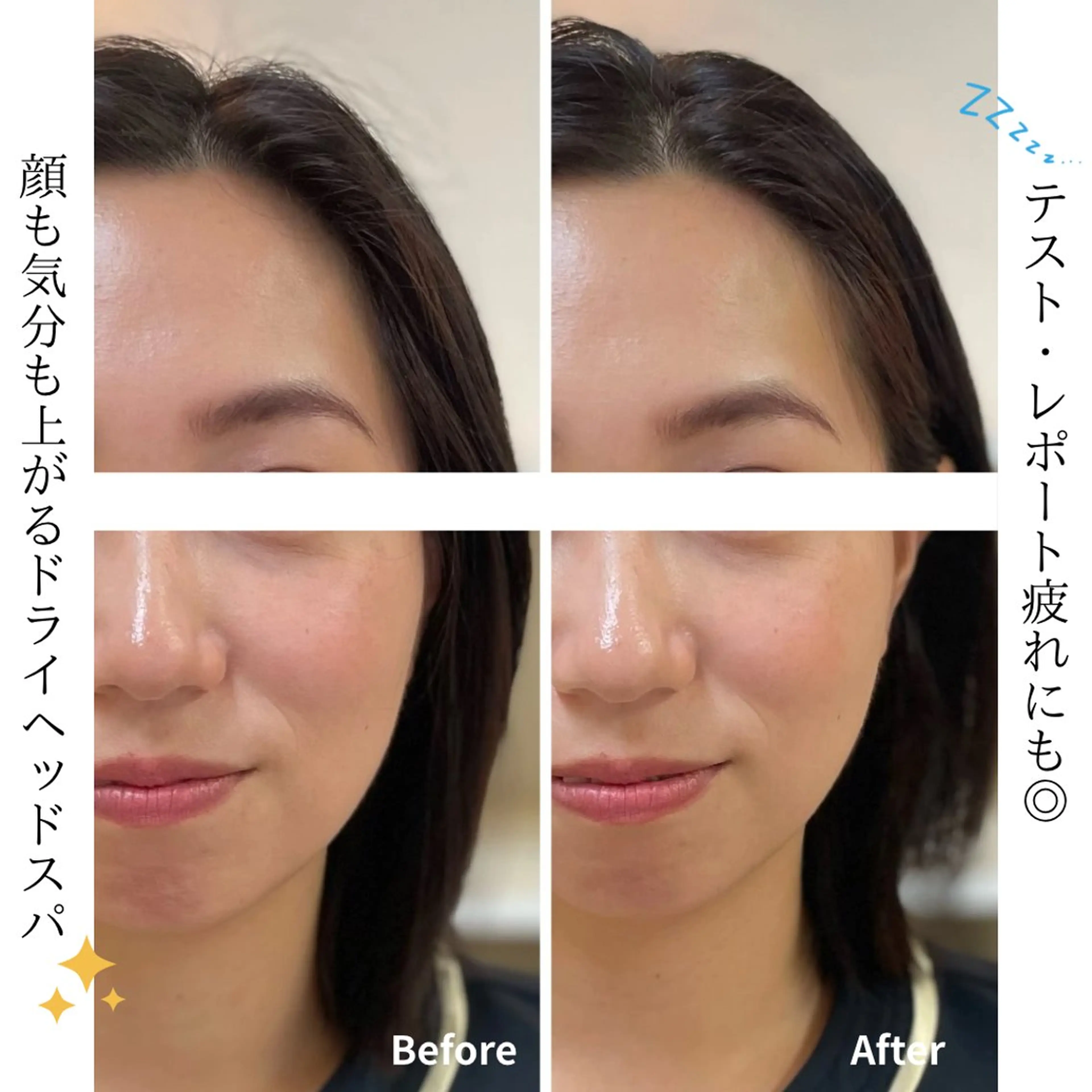 ヘッドスパ 英賀保/肌質改善 /やまもとのエステ・リラクイメージ