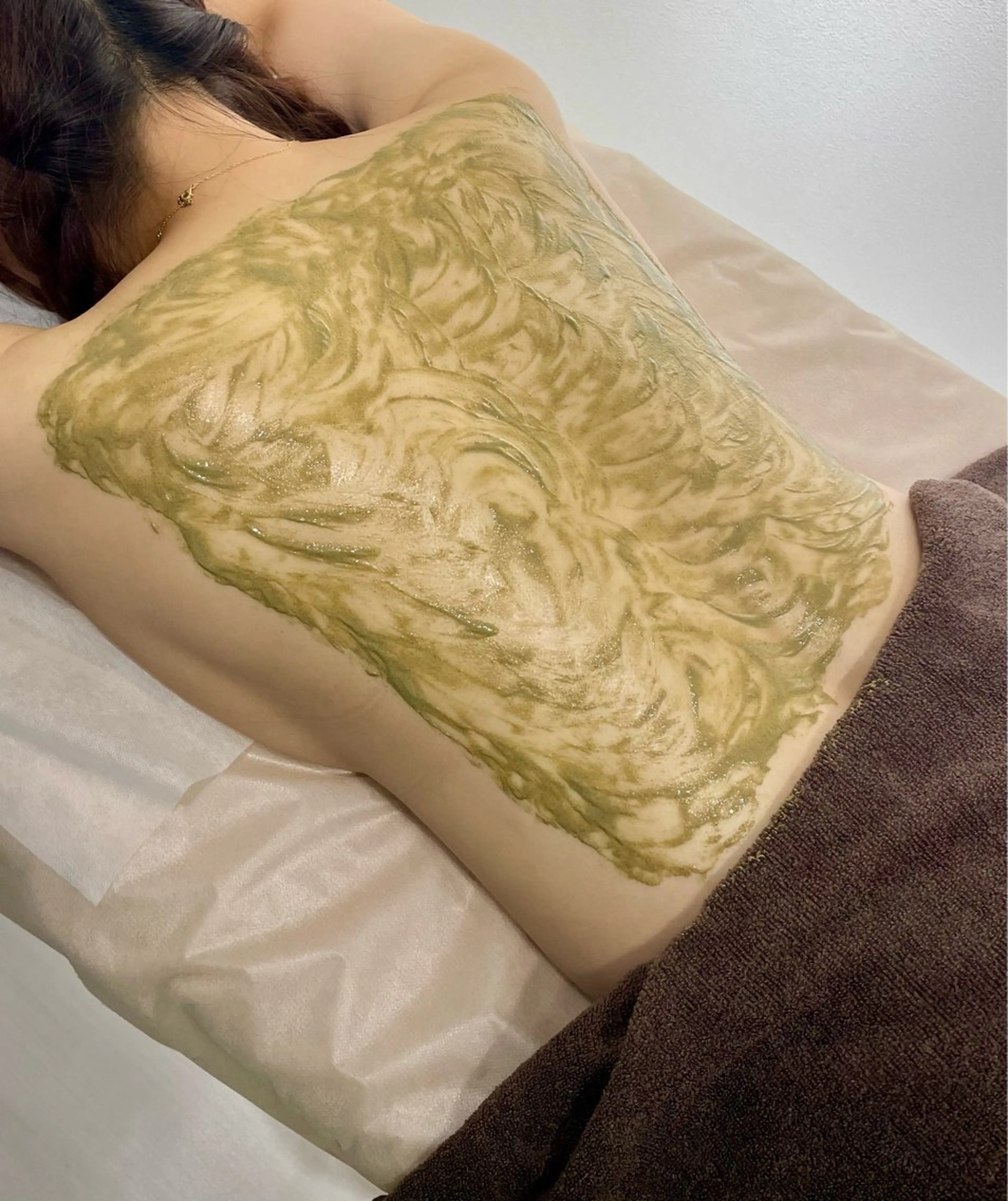 オープン記念/背中剥離なし/ハーブピーリングの写真