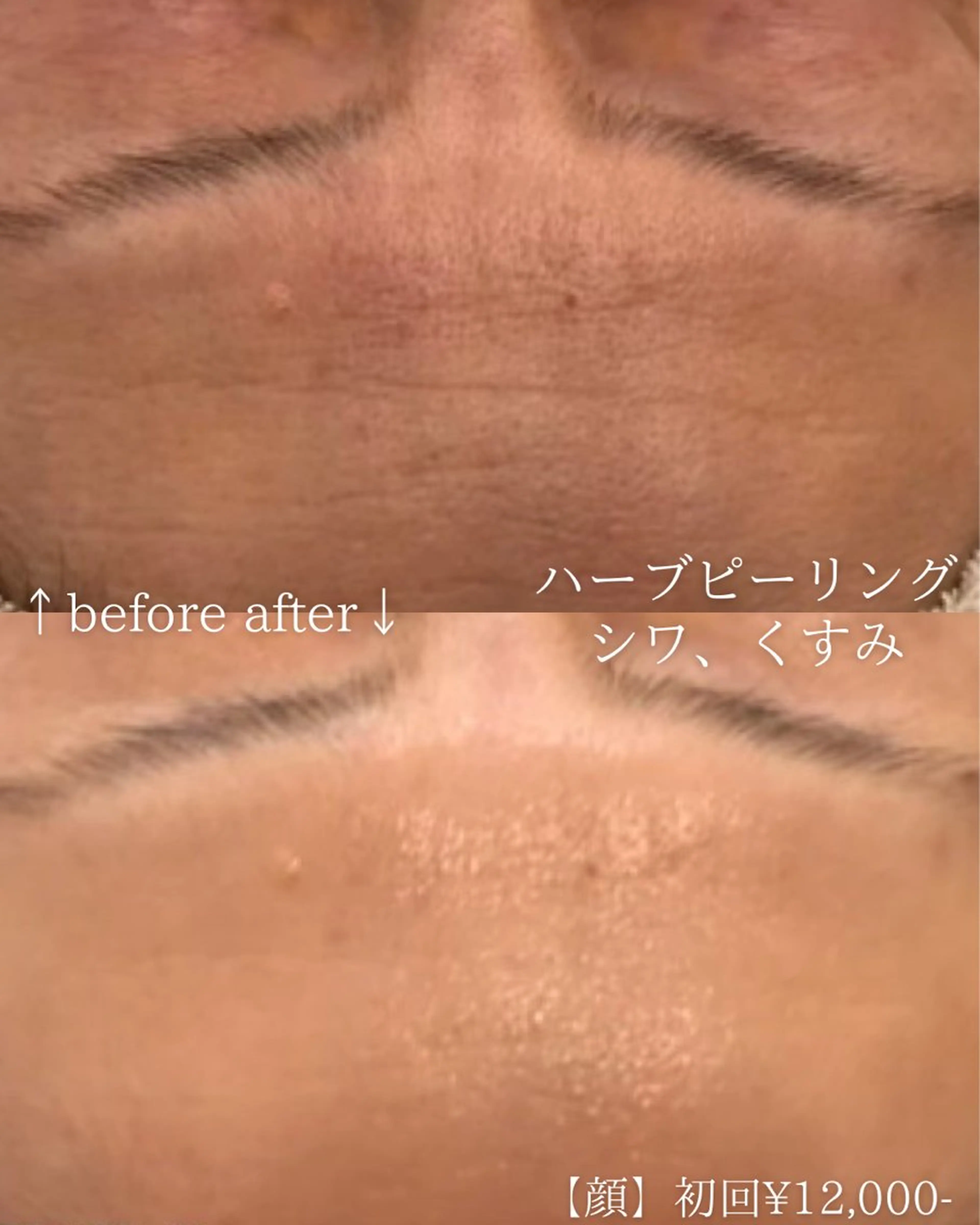 エステ ニキビ改善専門店 d'Albaのエステ・リラクイメージ