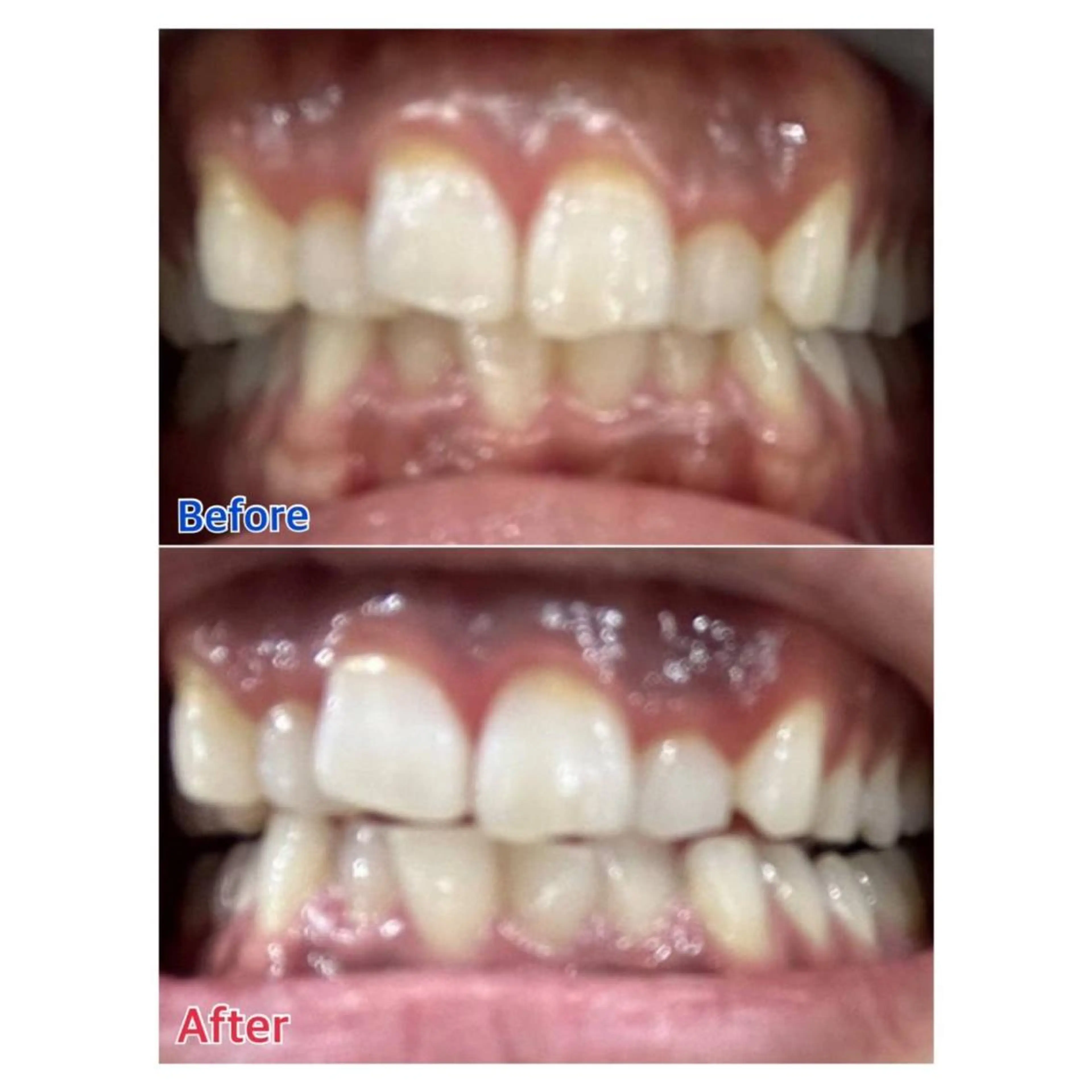 MBEAUTYSALON 千葉店・京成大久保所属・Melty 輝のその他イメージ