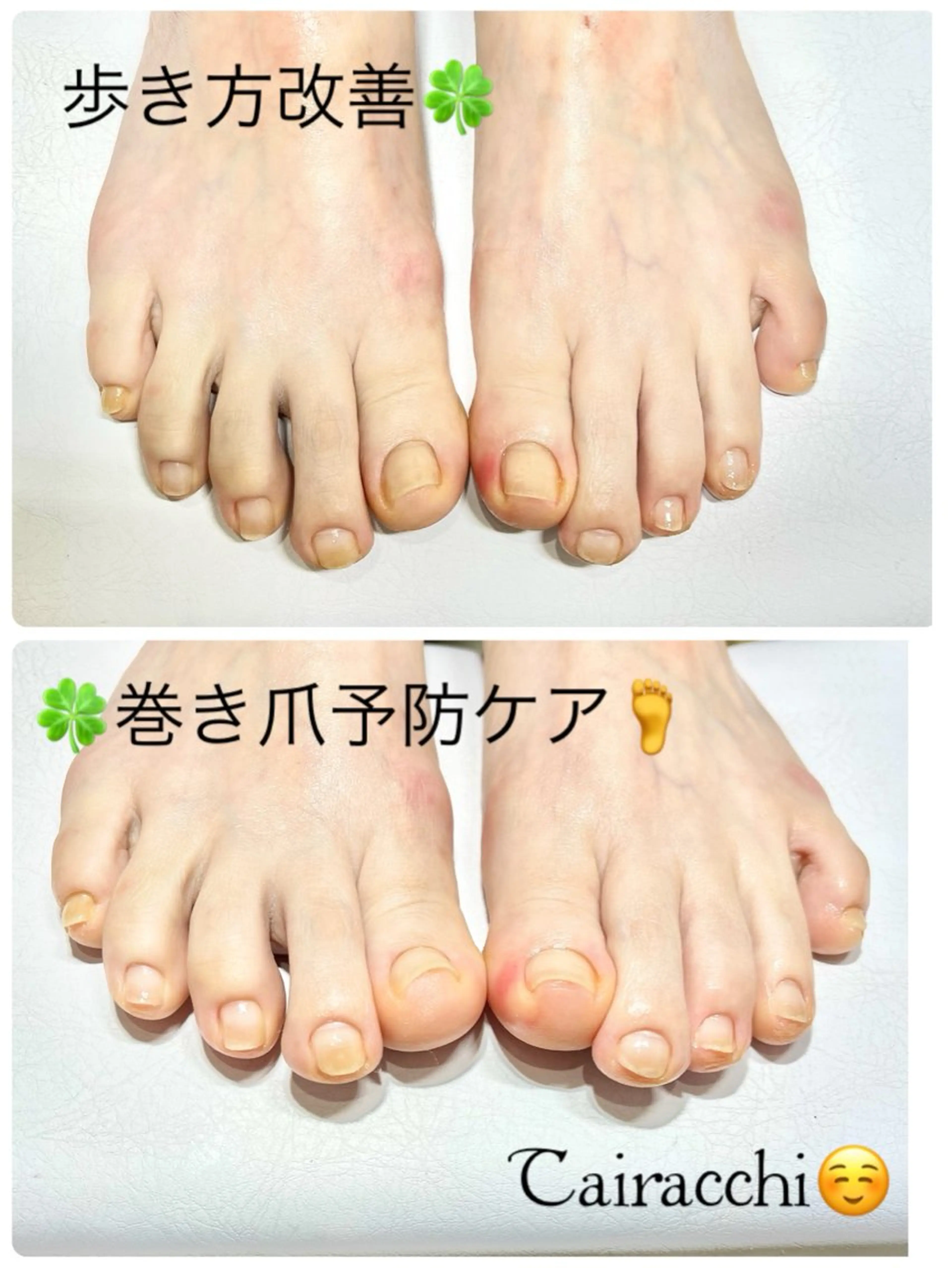 ネイル フットネイル フットネイル Tairacchi ﾀｲﾗｯﾁのネイルデザイン