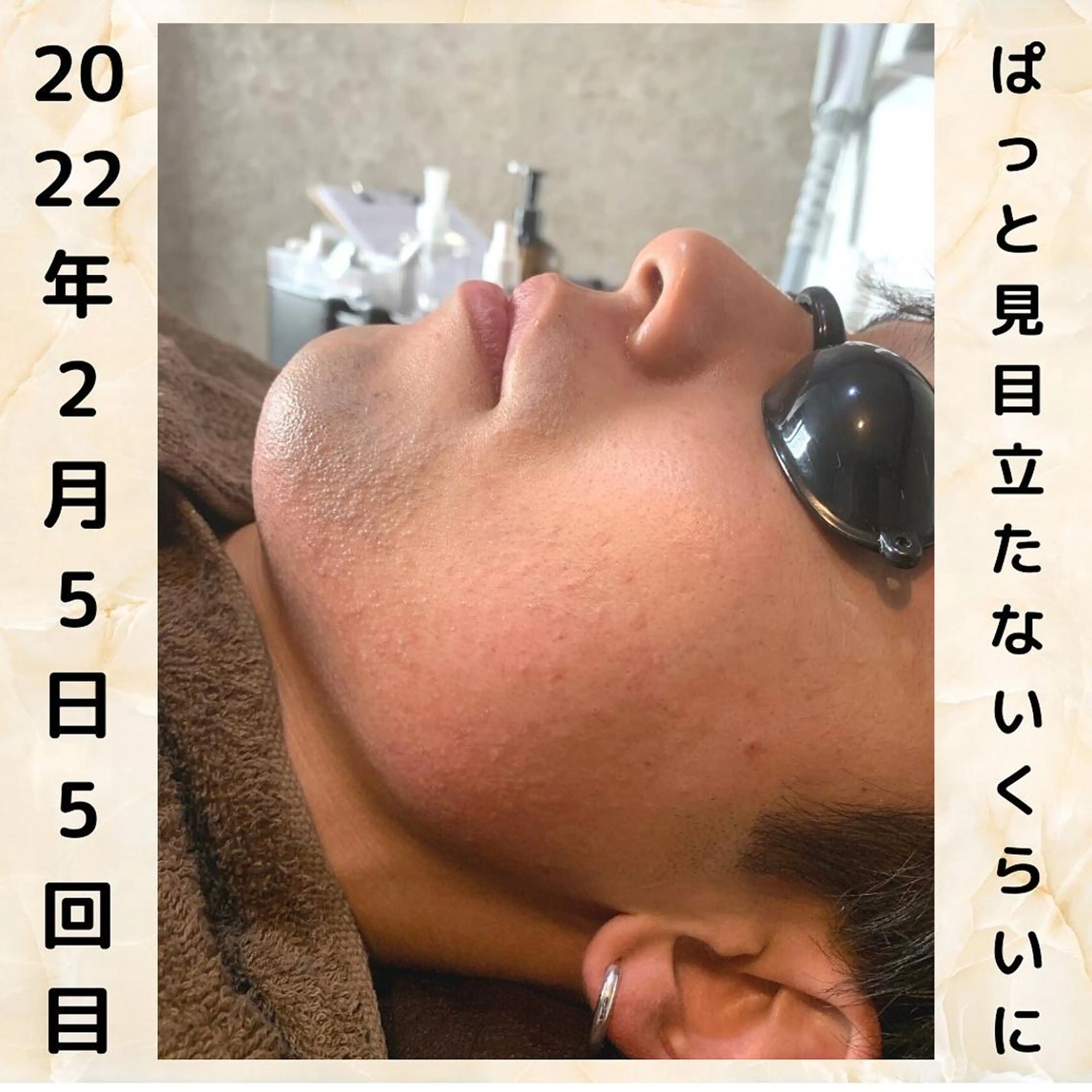 メンズ 20代から始める脱毛 salonLEPIAのエステ・リラクイメージ