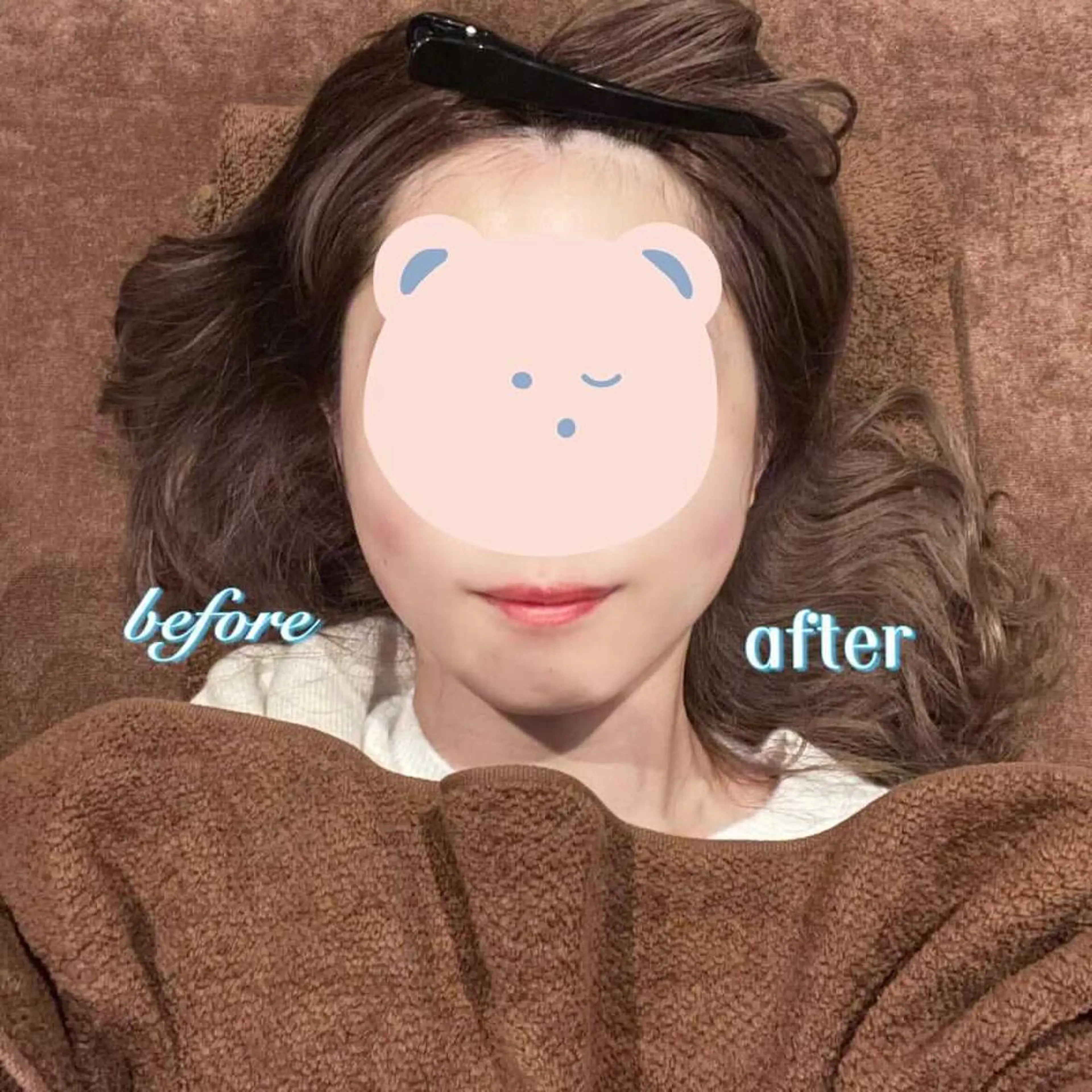 美容鍼灸サロン LOMIHARIのエステ・リラクイメージ