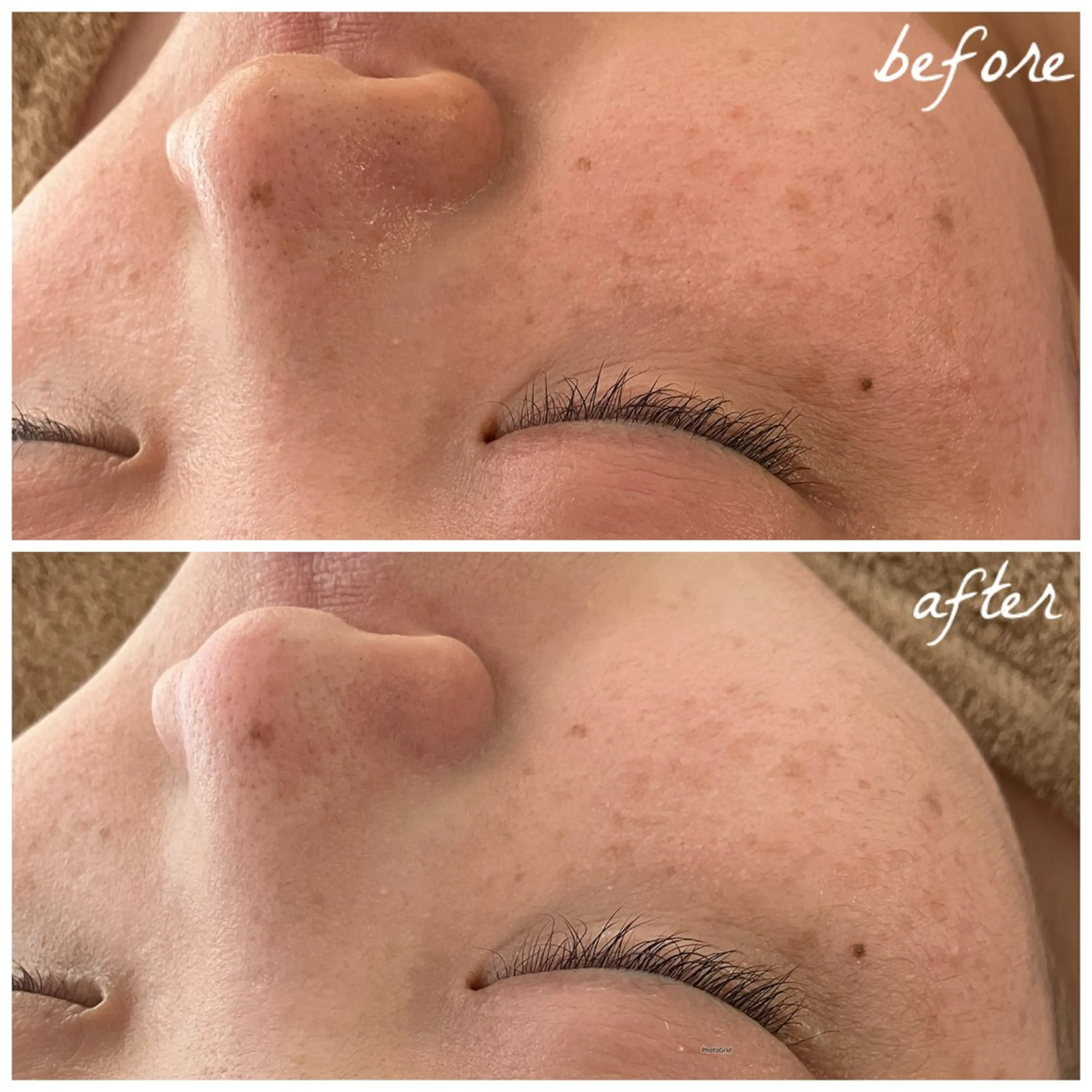 メンズ エステ メナード岐阜茜部 杉浦のエステ・リラクイメージ