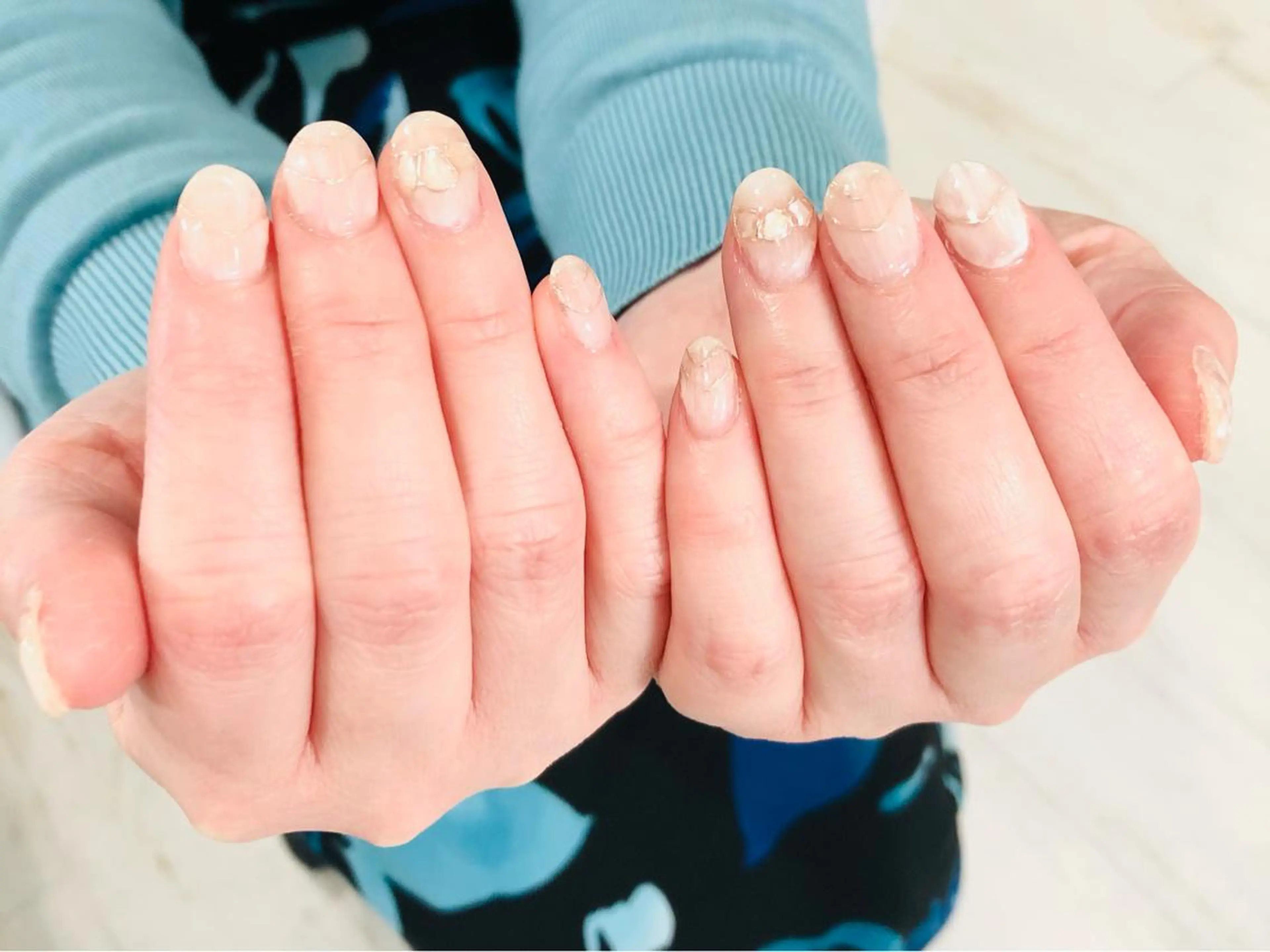 ネイル 入学式 フラッシュネイル フレンチネイル 卒業式 ラメ(グリッター) H3(エイチスリー)所属・H3 hitoのネイルデザイン