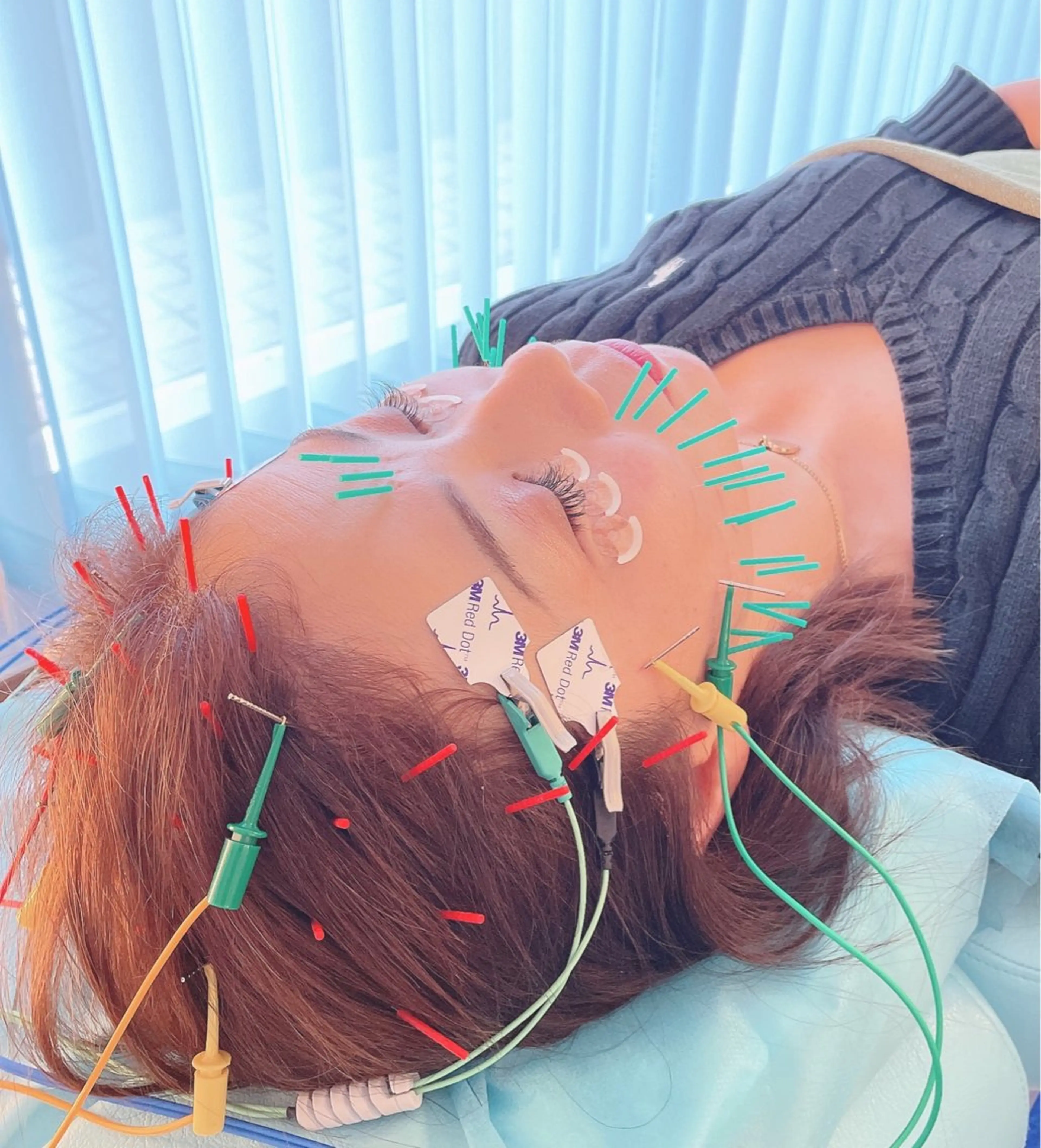 エステ リラク 小顔美容鍼専門サロン 渋谷YZのエステ・リラクイメージ