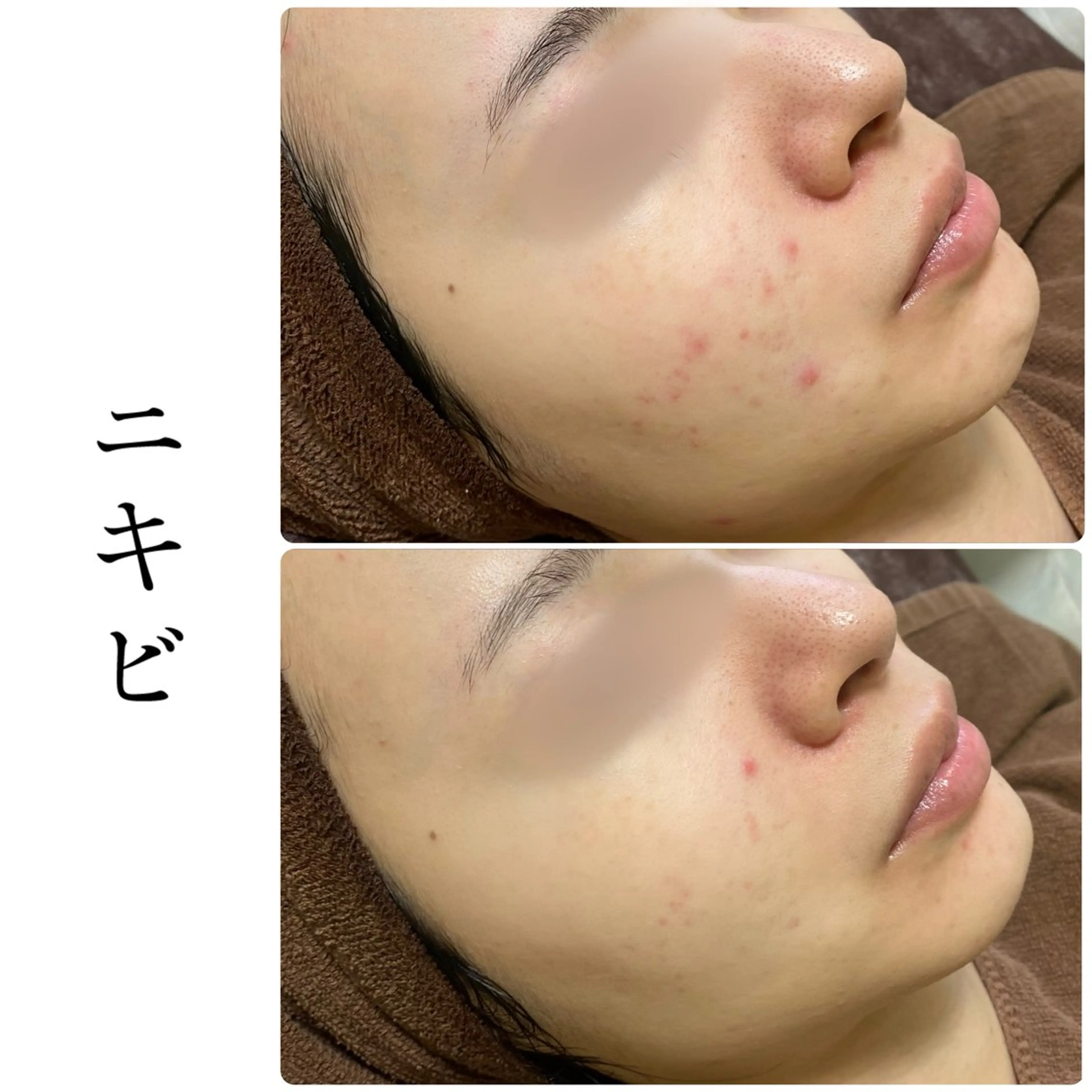 エステ ハーブピーリング専門 BIOEL横浜のエステ・リラクイメージ