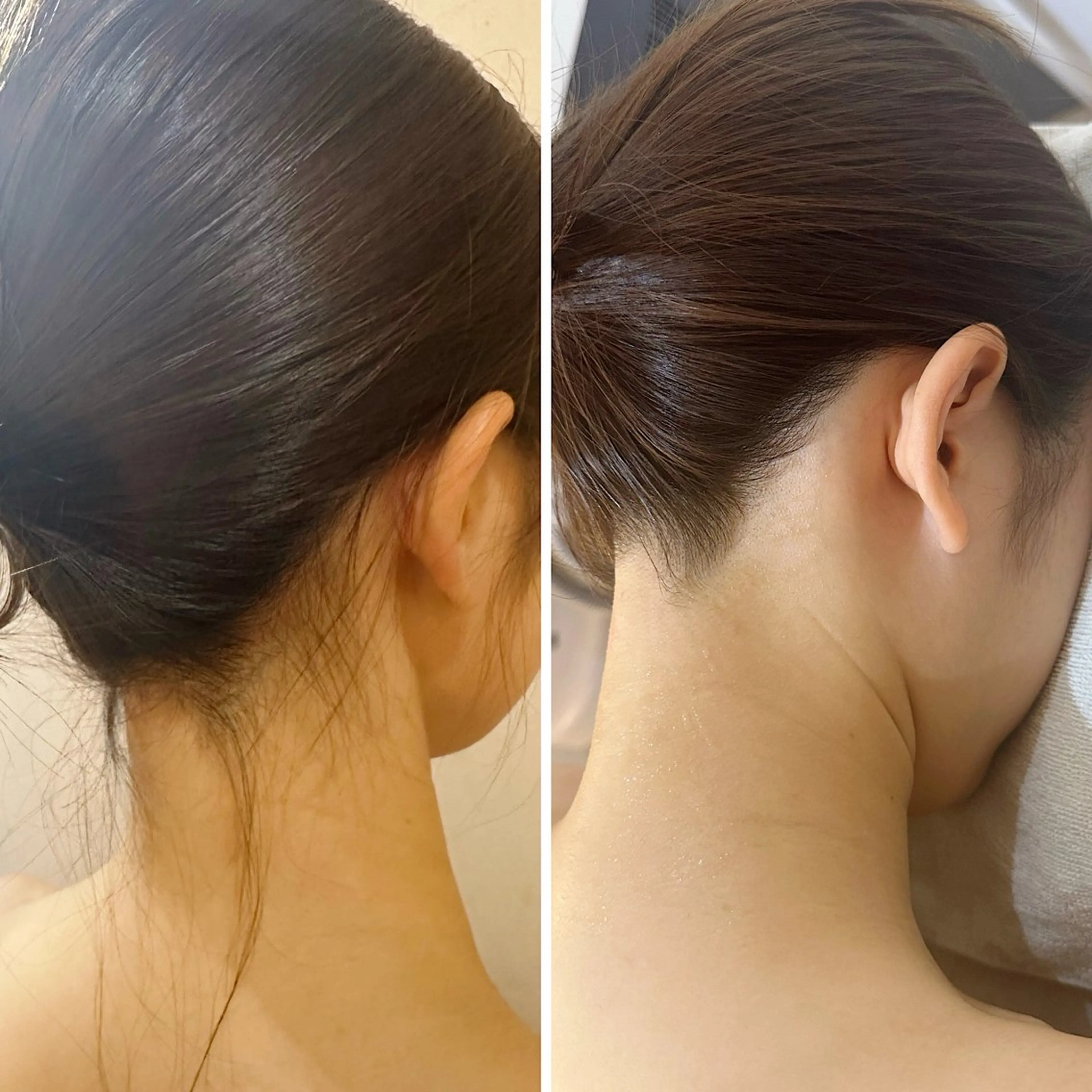 脱毛 うなじ脱毛/美肌脱毛 LABELのエステ・リラクイメージ