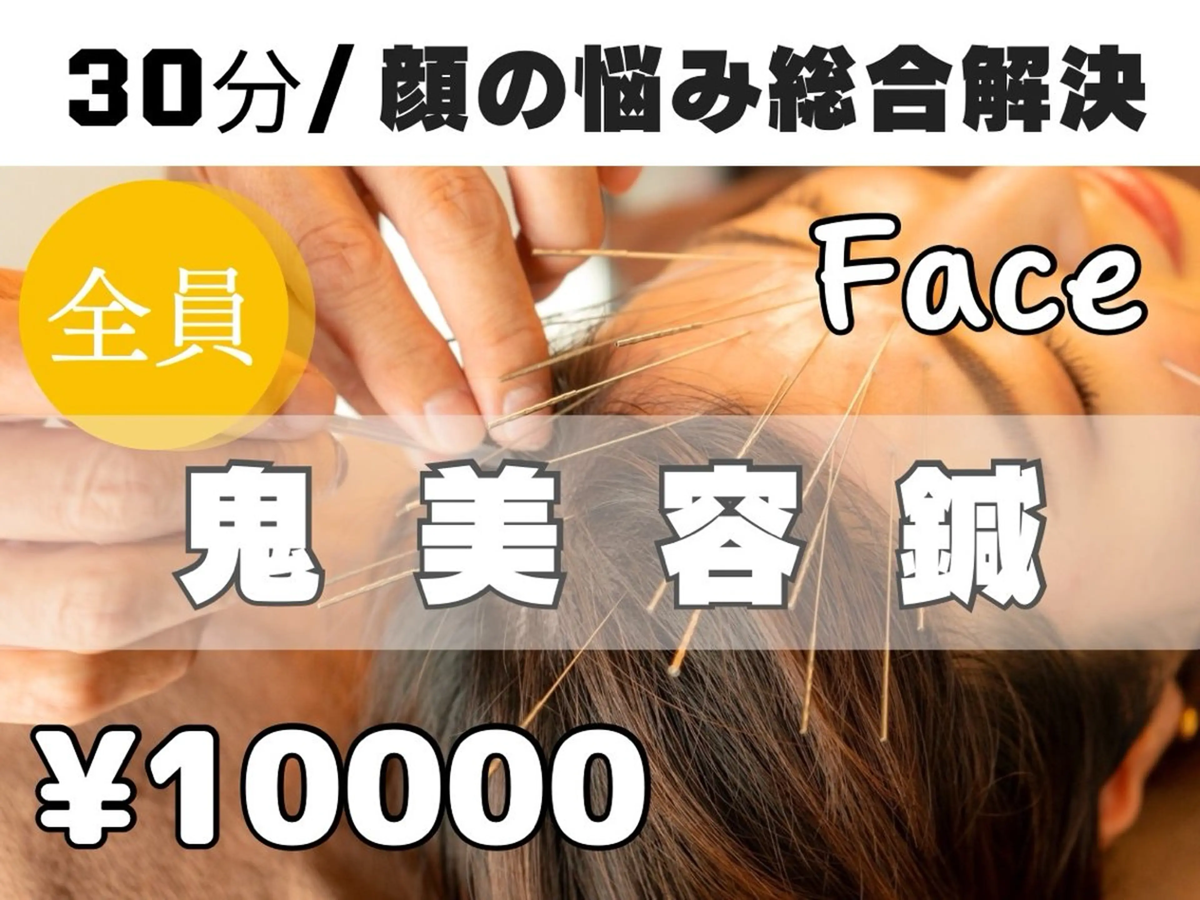【驚異の小顔実感！】ルート鬼美容鍼30分¥10,000の写真