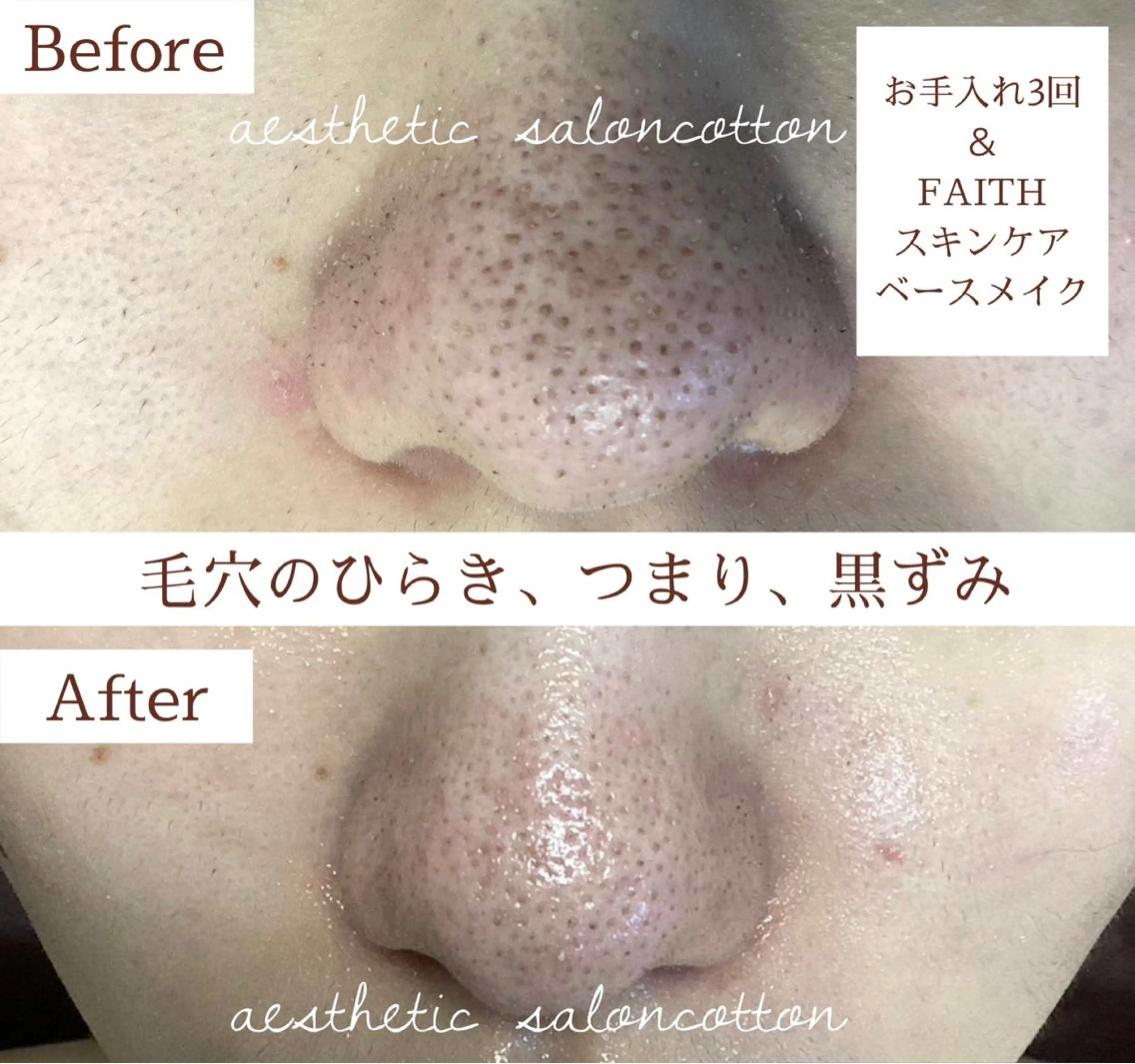 エステ 都度払い 肌質改善専門サロンのエステ・リラクイメージ