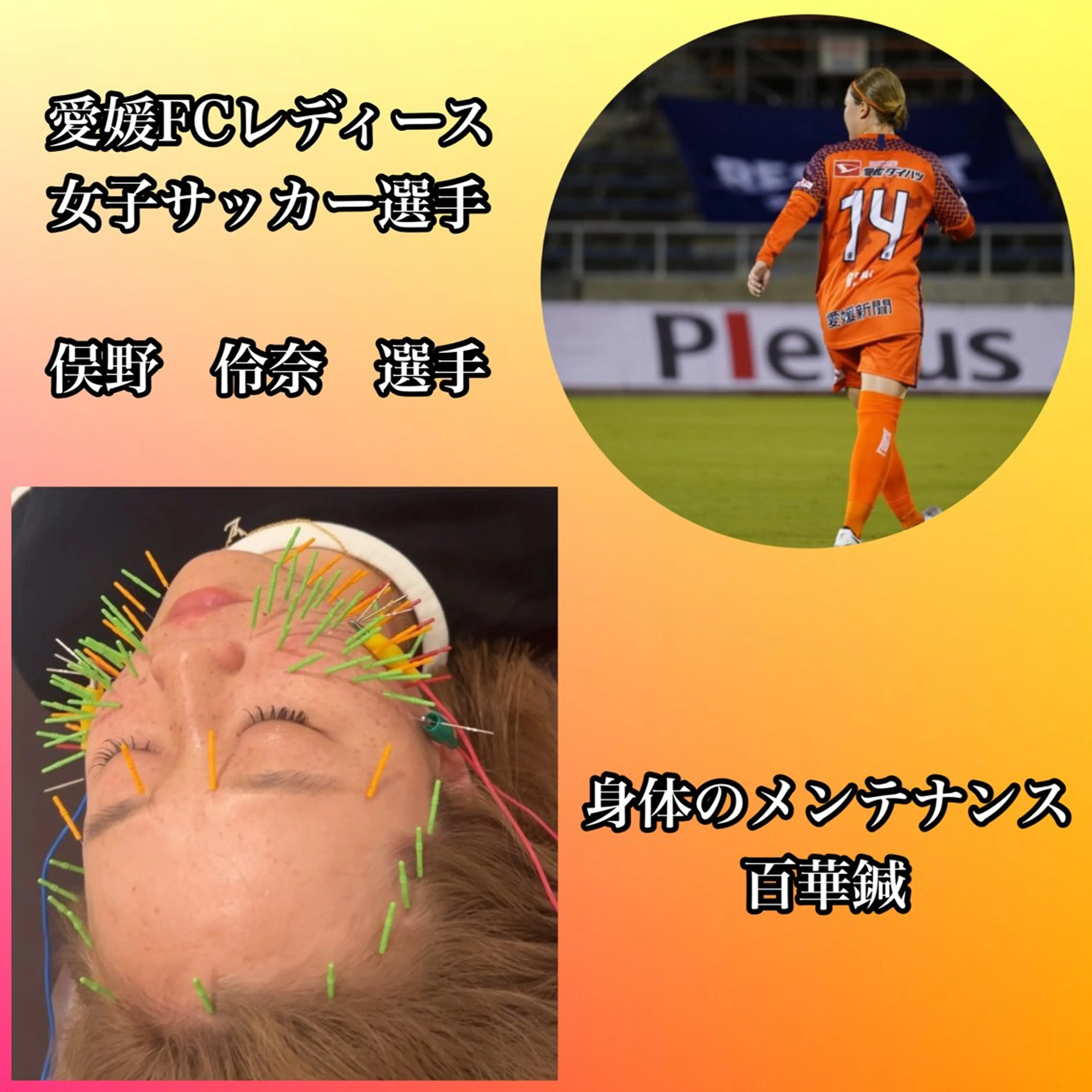 エステ リラク 美容鍼灸Solana所属・肌質改善×美容鍼 ゆいのエステ・リラクイメージ