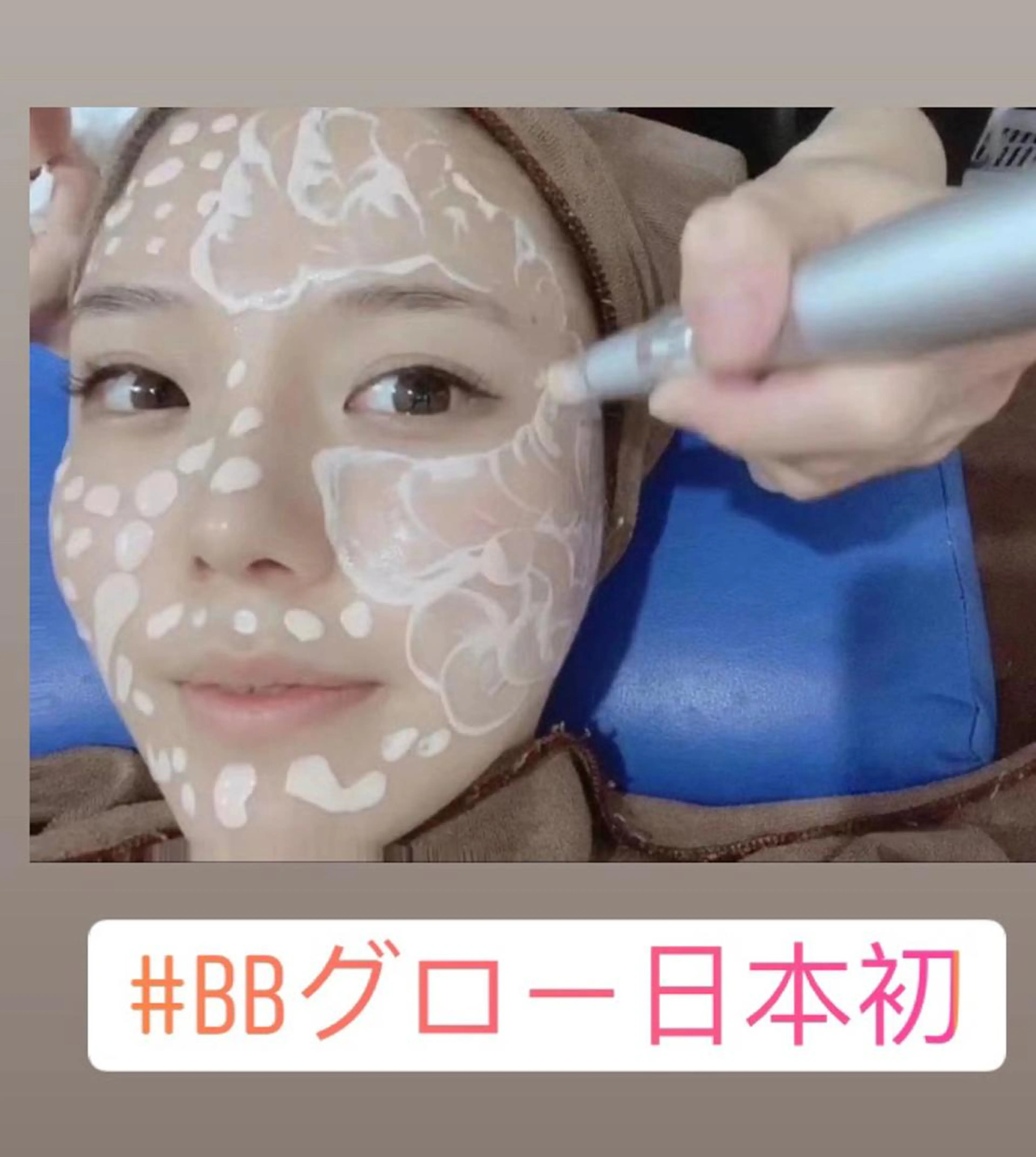 BBグローの写真