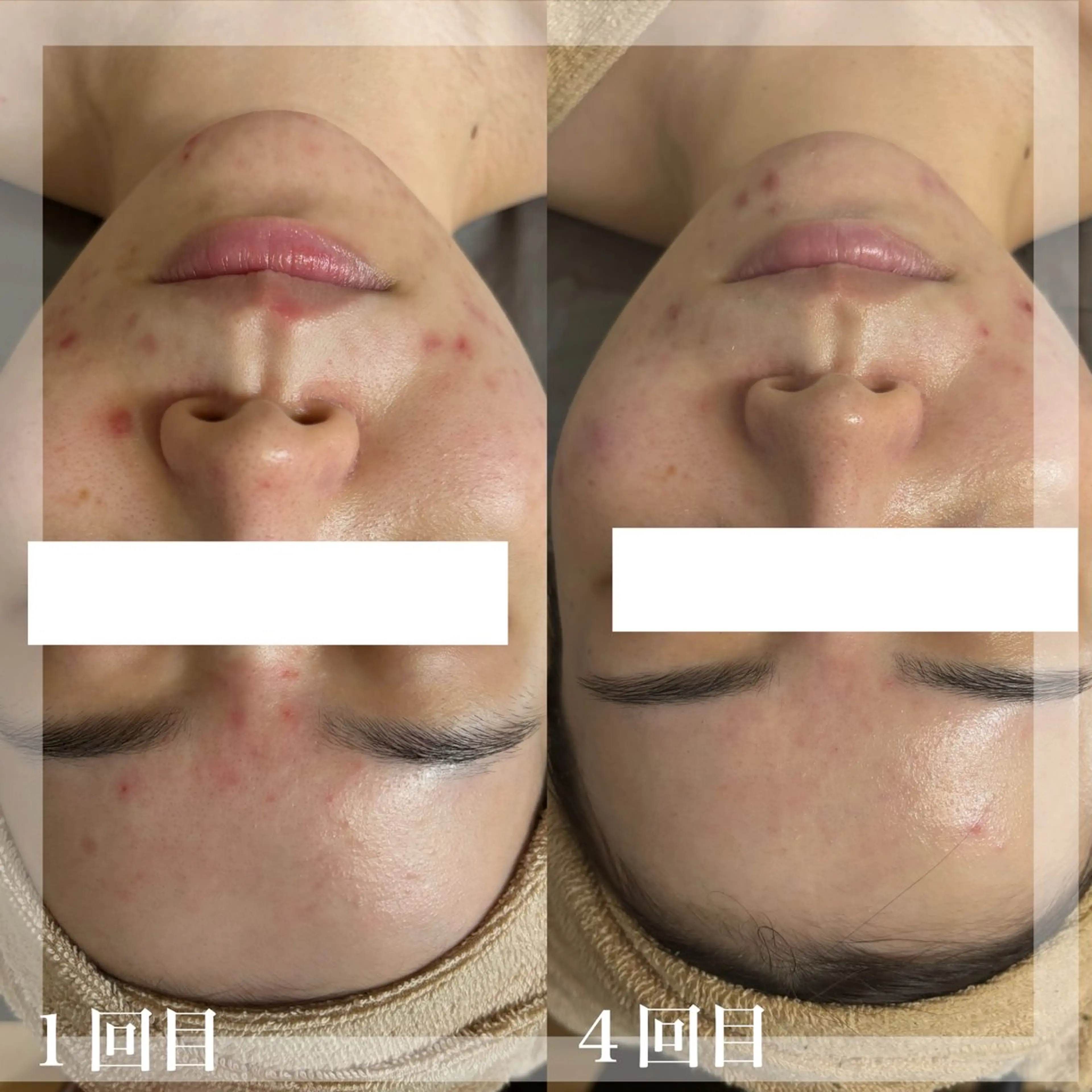 エステ WHITE AQUA 北千住店のエステ・リラクイメージ