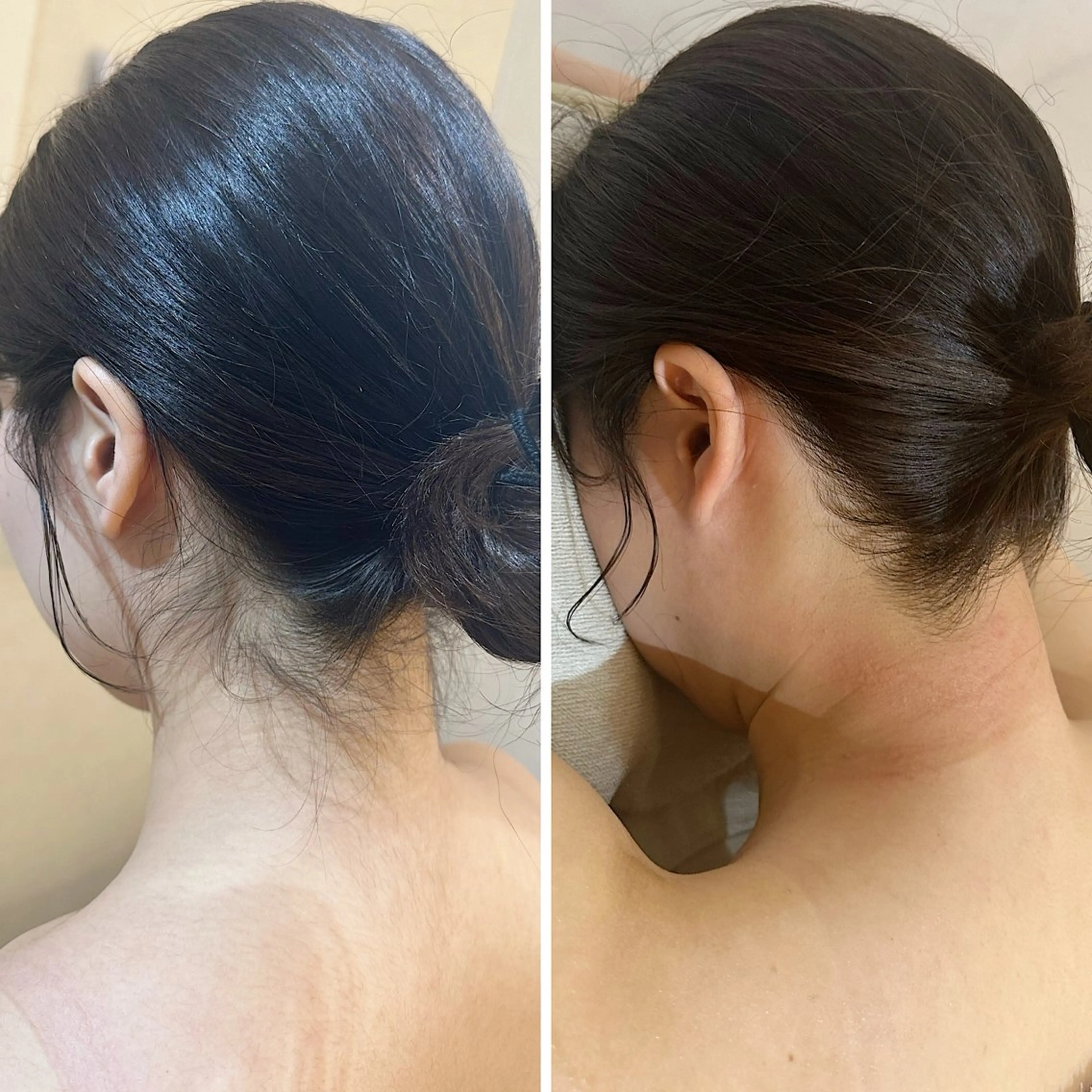 うなじ脱毛/美肌脱毛 LABELのエステ・リラクイメージ